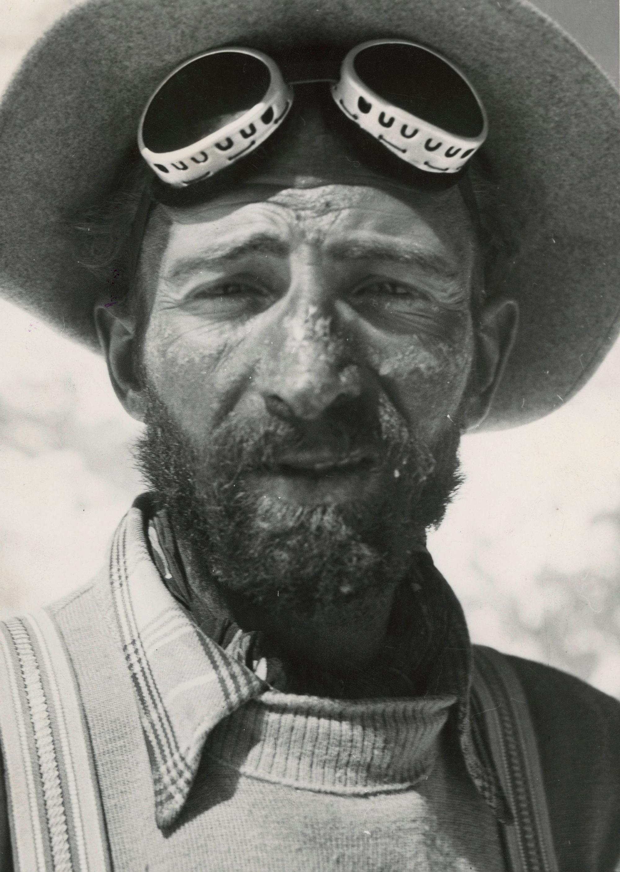 Schwer gezeichnet: Herrmann Buhl nach seinem Abstieg vom Nanga Parbat.