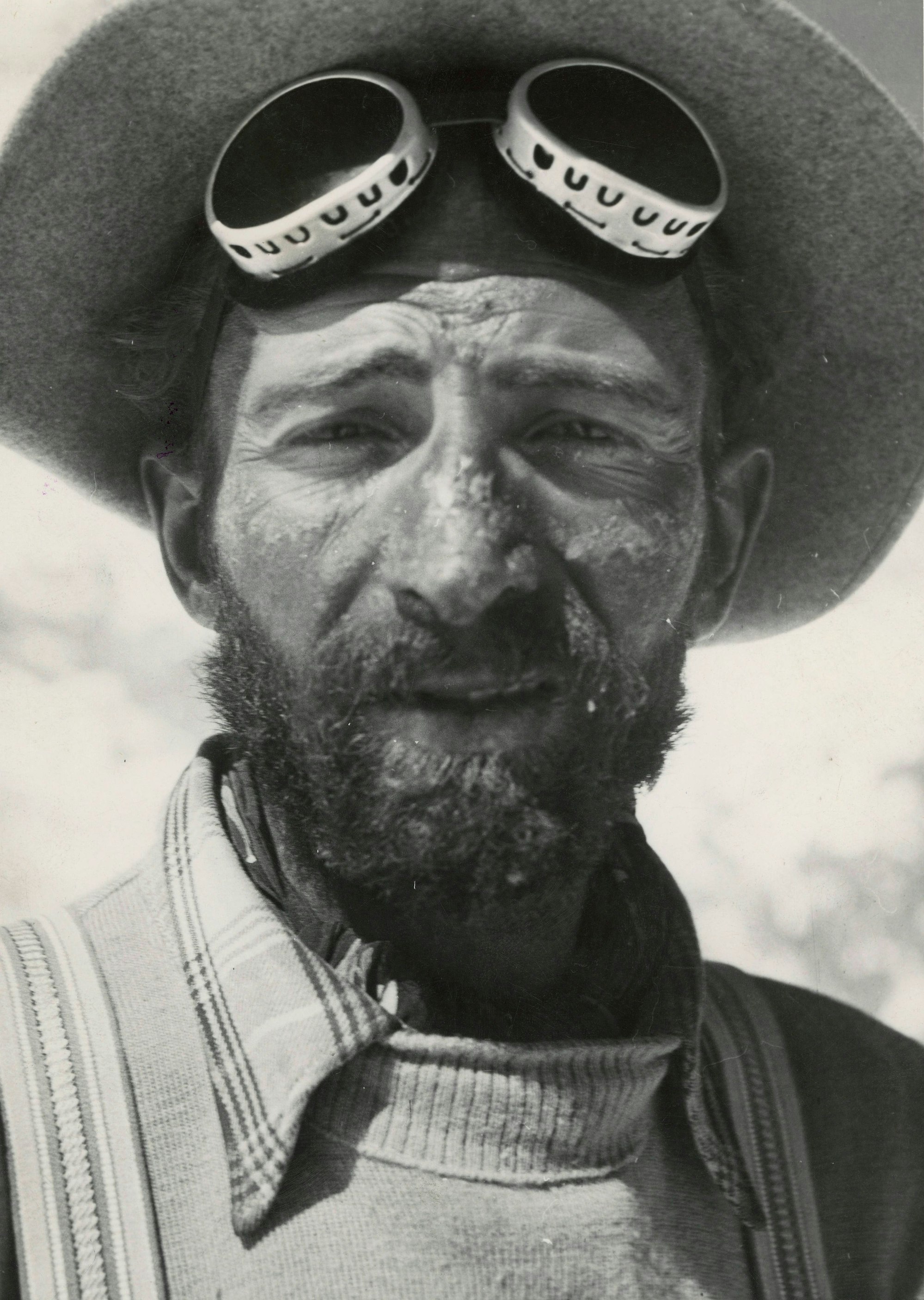 Schwer gezeichnet: Herrmann Buhl nach seinem Abstieg vom Nanga Parbat.