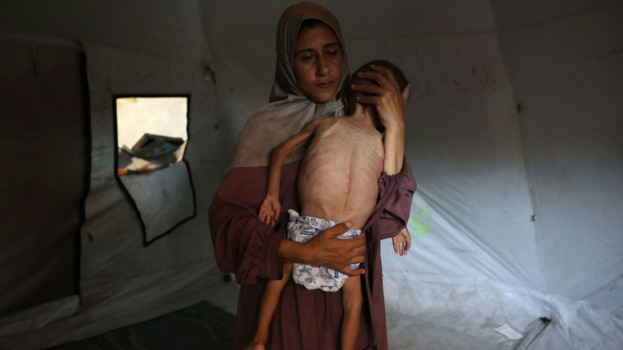 Die Mutter von Mohammed al-Mutawaq hält ihren abgemagerten Sohn in den Armen.