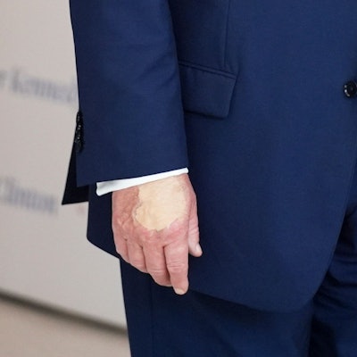 22.08.2025, USA, Washington: Die Hand von US-Präsident Donald Trump, während er im Museum The People's House spricht. Foto: Evan Vucci/AP/dpa +++ dpa-Bildfunk +++