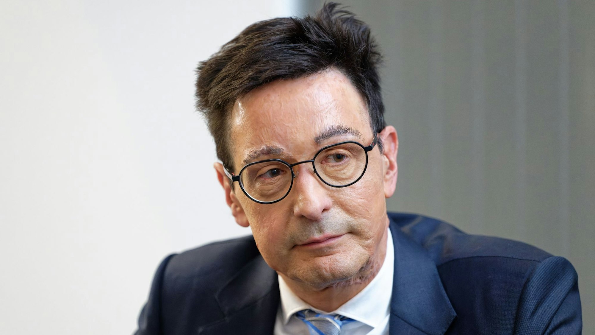 Bernhard Günther wurde Opfer eines Säure-Anschlags. (Archivbild)