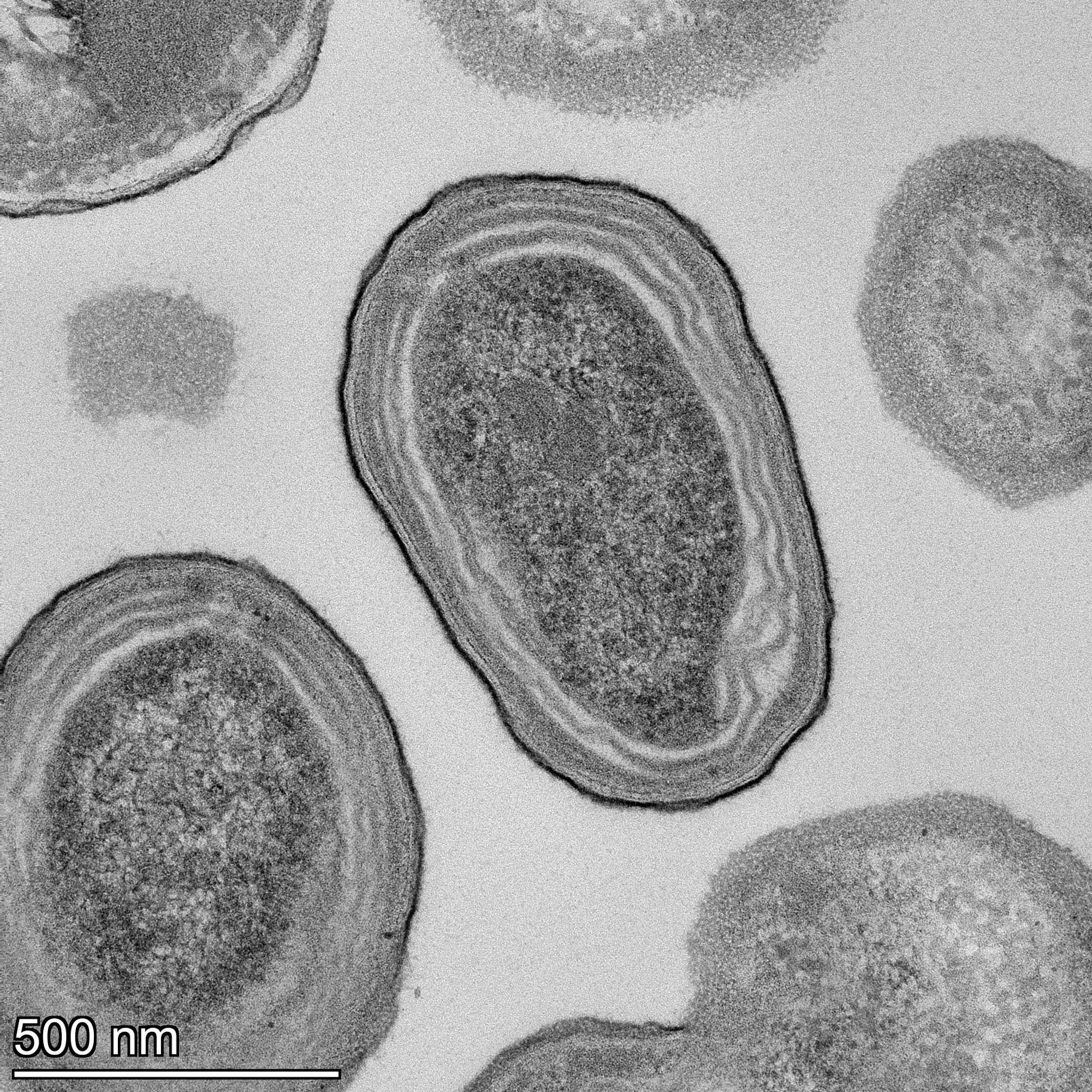 Elektronenmikroskopische Aufnahme von Prochlorococcus-Zellen.