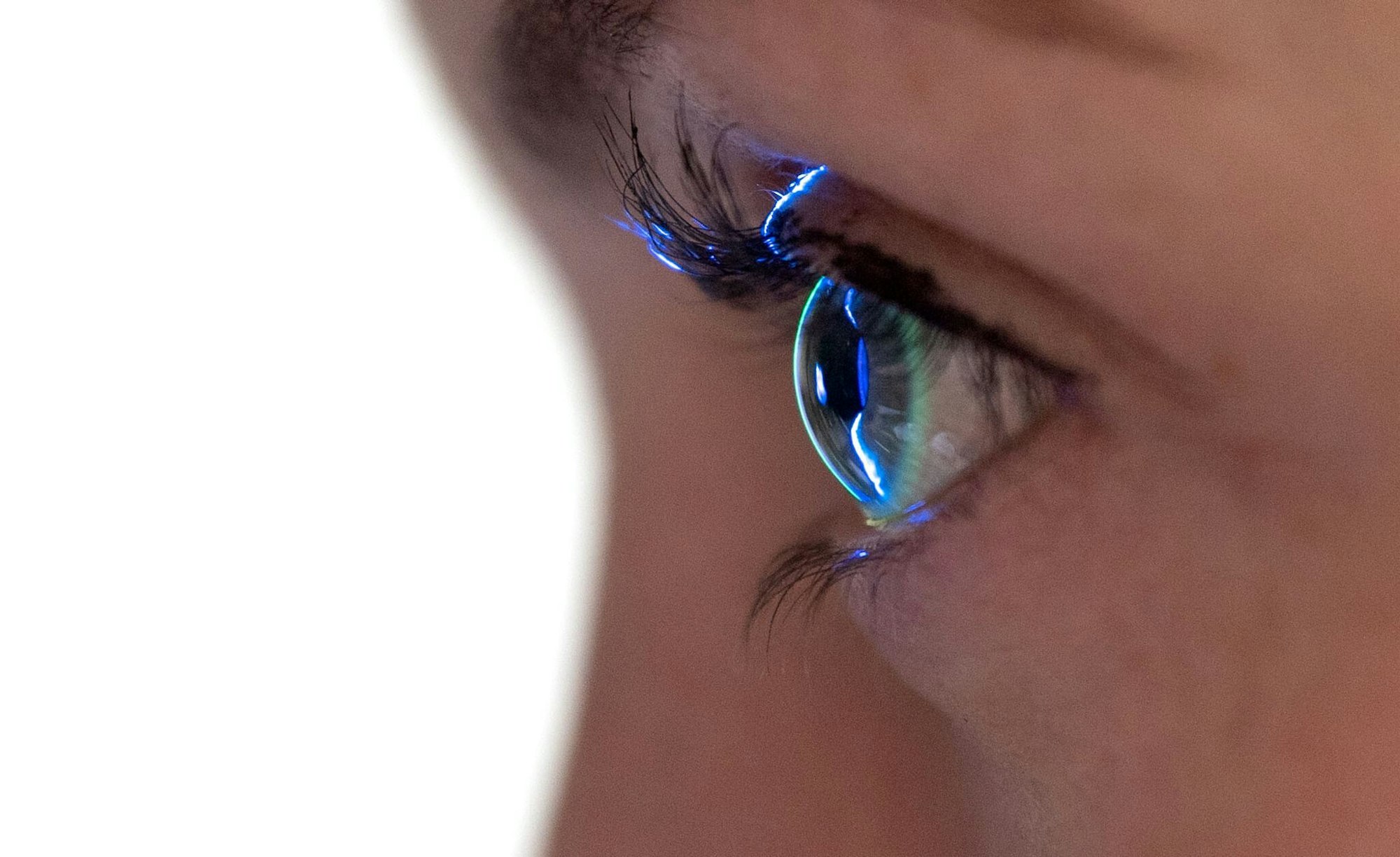 Fremdkörper im Auge? Vorsichtig ausspülen oder doch zum Arzt – es kommt drauf an.