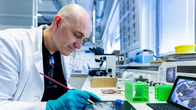 Im Forschungszentrum Jülich werden menschliche Gehirne in hauchdünne Scheiben geschnitten. Laborleiter Markus Cremer richtet einen der Schnitte mit einem Pinsel.