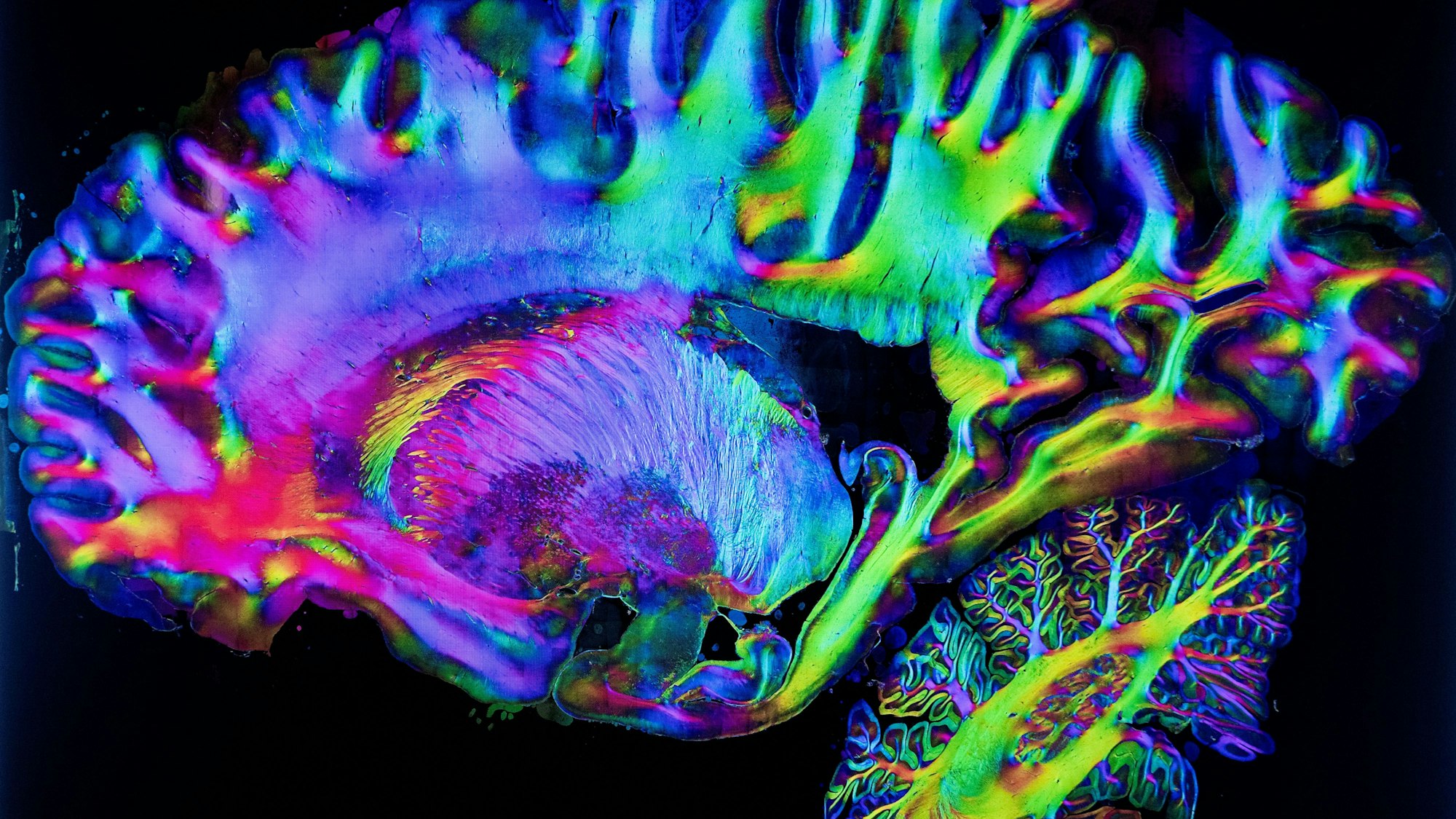 10.09.2025, Jülich: Im Forschungszentrum Jülich schneiden Forschende im Institut für Neurowissenschaften und Medizin menschliche Gehirne in hauchdünne Scheiben. Die sogenannten PLI-Aufnahmen sind wissenschaftlich sehr wertvoll. Foto: Thilo Schmülgen