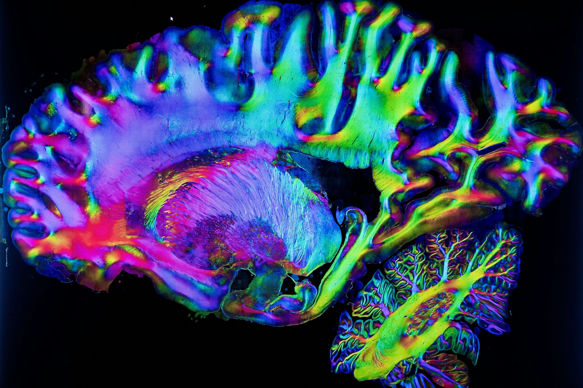 Die Verläufe von Nervenfasern werden durch das in Jülich entwickelte Verfahren in verschiedenen Farben dargestellt.