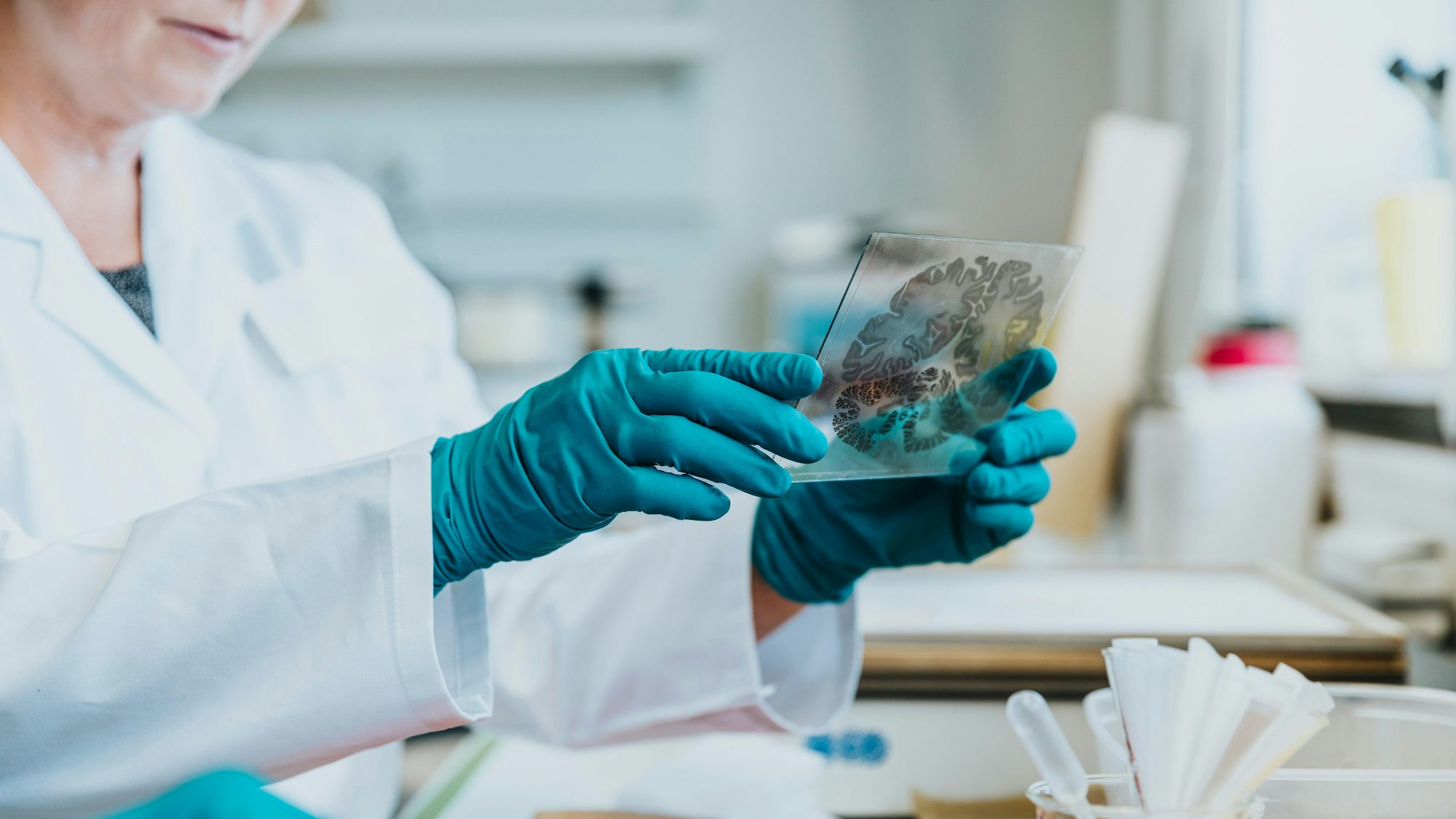 Ein haudünner Gehirnschnitt, angefertigt im Forschungszentrum Jülich, wird in Glasscheiben eingebettet.