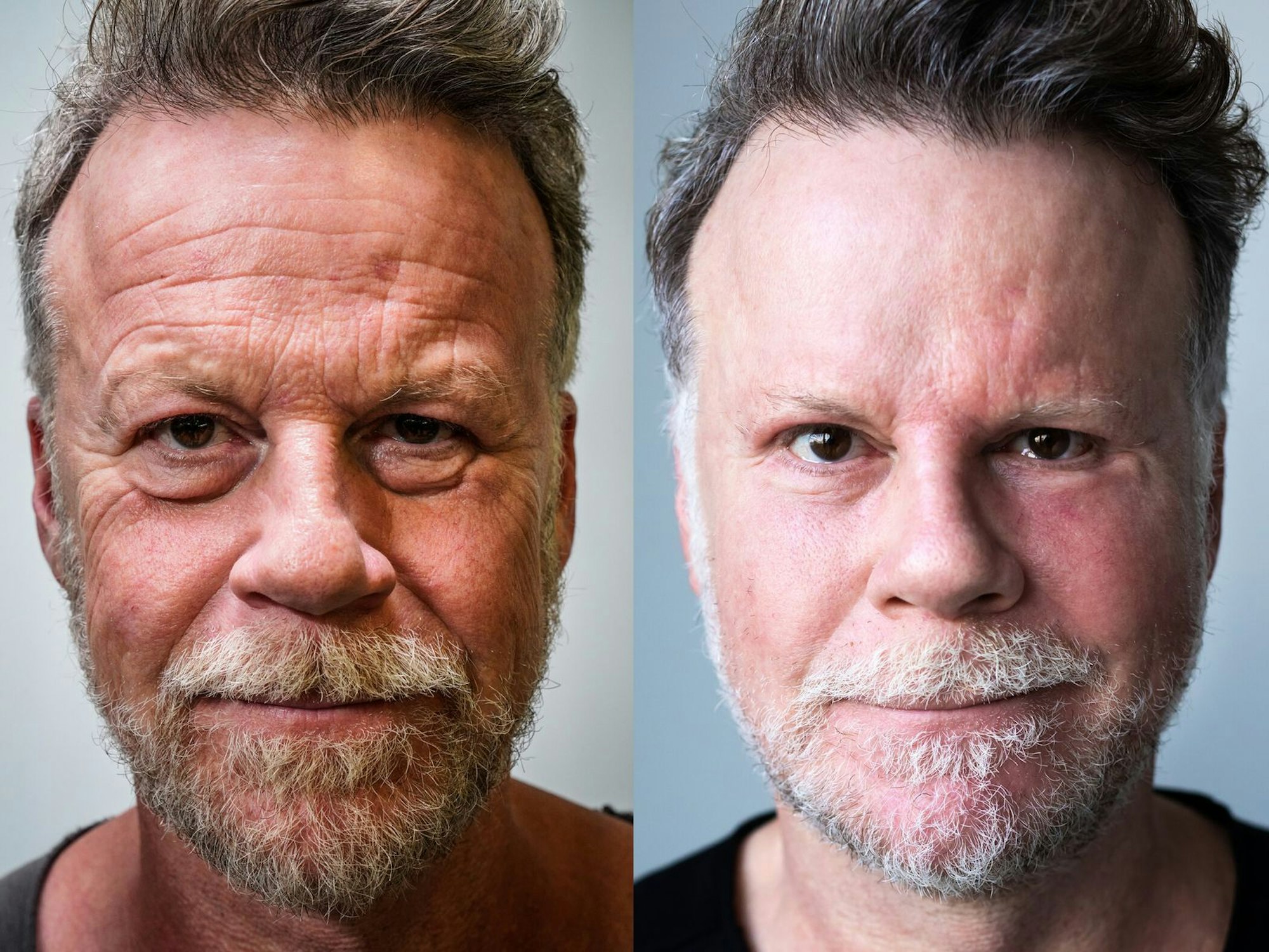 Mit seinem „Schönheits-Experiment“ machte Jenke von Wilmsdorff Schlagzeilen wie mit keinem anderen Selbstversuch. (Bild: ProSieben / Bene Müller)