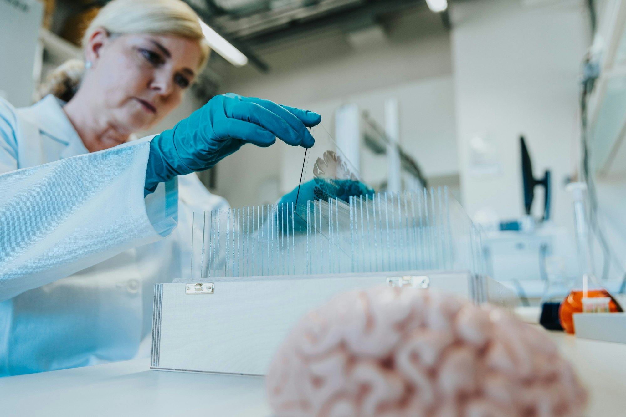 Die haarfeinen Hirnschnitte werden im Forschungszentrum Jülich auf Glasträger gezogen.