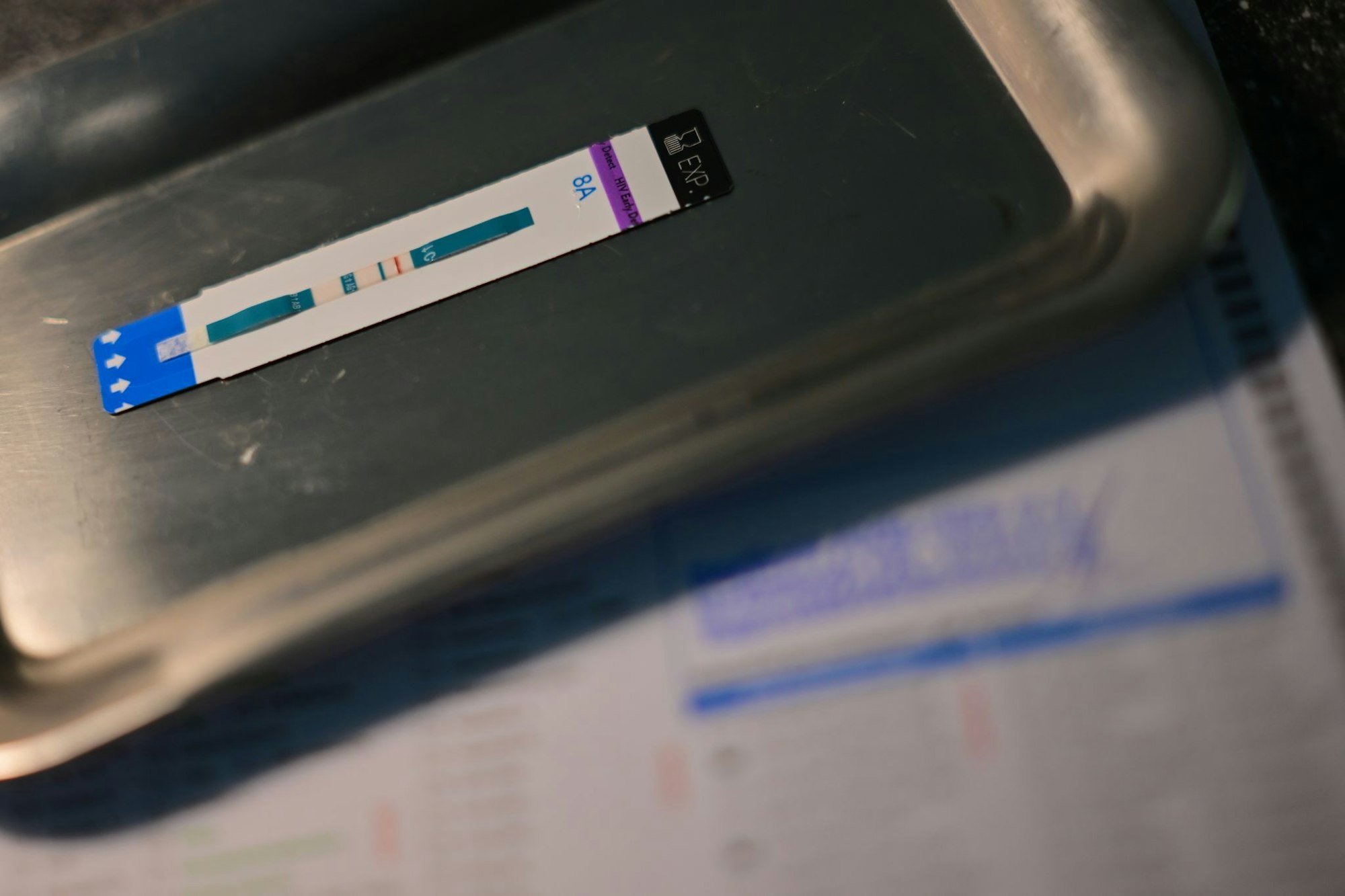 HIV-Diagnosen werden oft erst Jahre nach der Infektion gestellt. (Symbolbild)