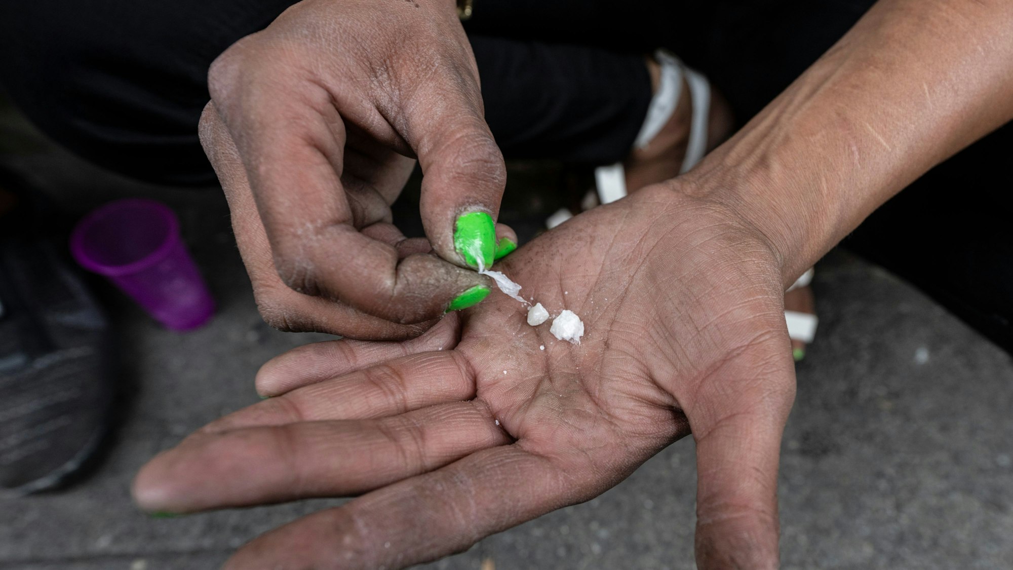 Eine Abhängige hält sogenannte „Crack-Steine“ in ihrer Hand.