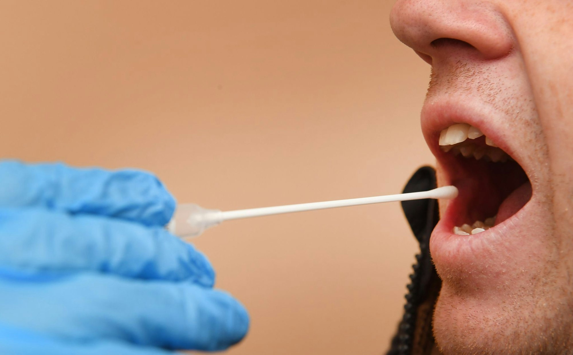 In Köln startet die Polizei eine großangelegte DNA-Untersuchung zur Aufklärung eines Mordfalls aus dem Jahr 1989. (Symbolbild)