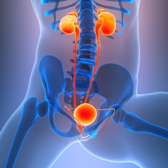 Ein epitheloides Angiosarkom zählt zu den seltenen Krebsarten.