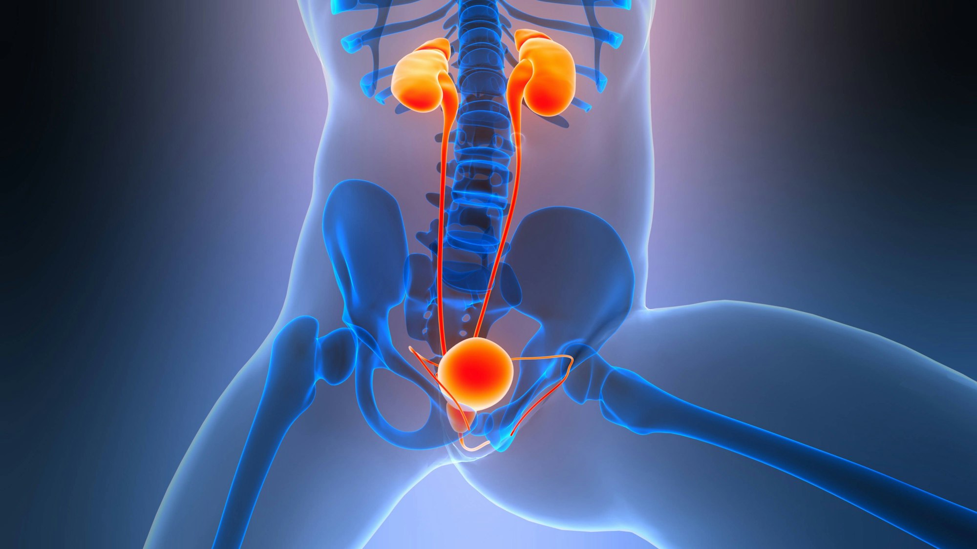 Ein epitheloides Angiosarkom zählt zu den seltenen Krebsarten.