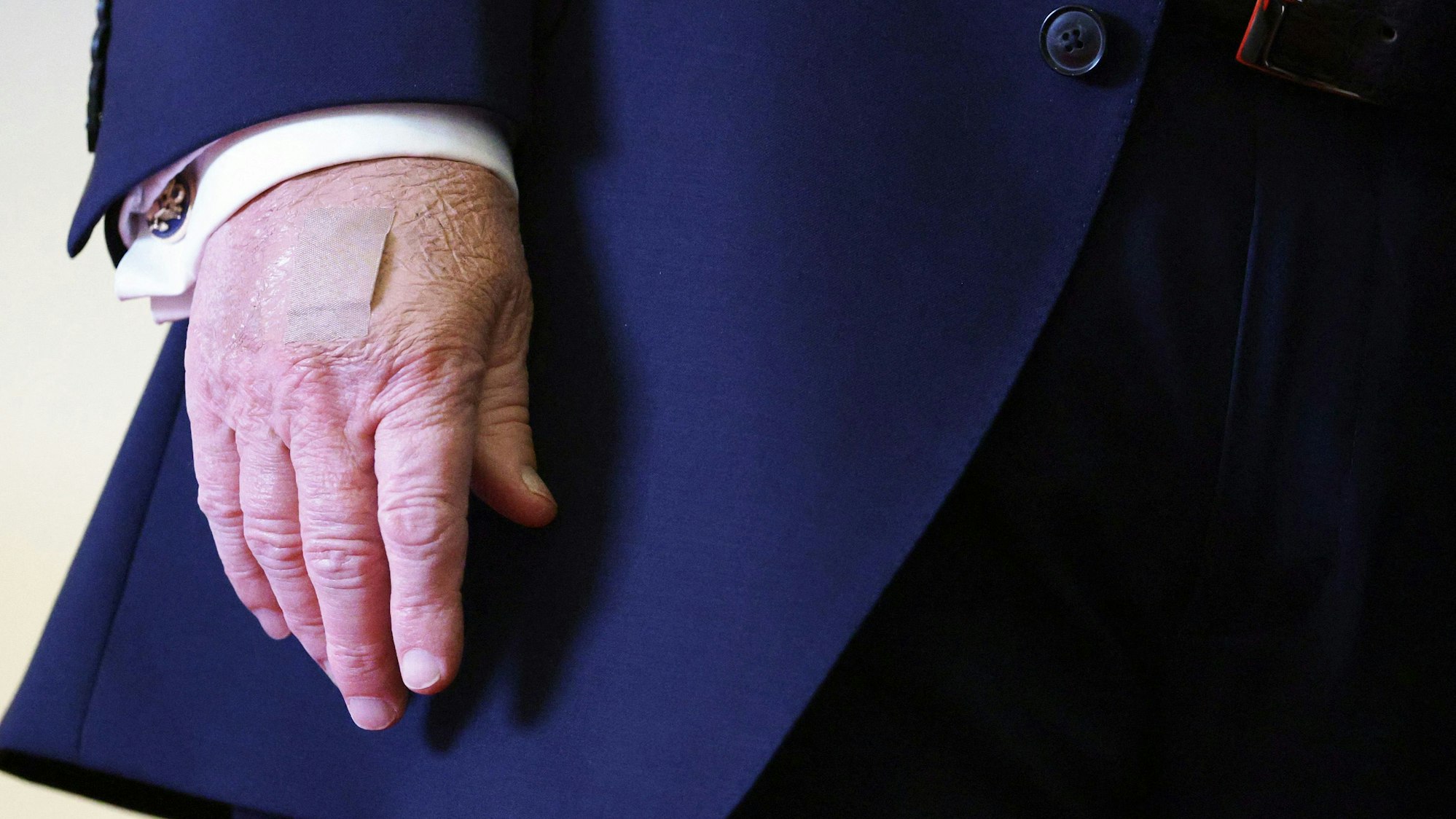 Blutergüsse und Pflaster auf der Hand von Donald Trump sorgen immer wieder für Spekulationen um seinen Gesundheitszustand. Auch am 9. Dezember trat Trump mit Make-up und Pflaster auf der Hand auf.