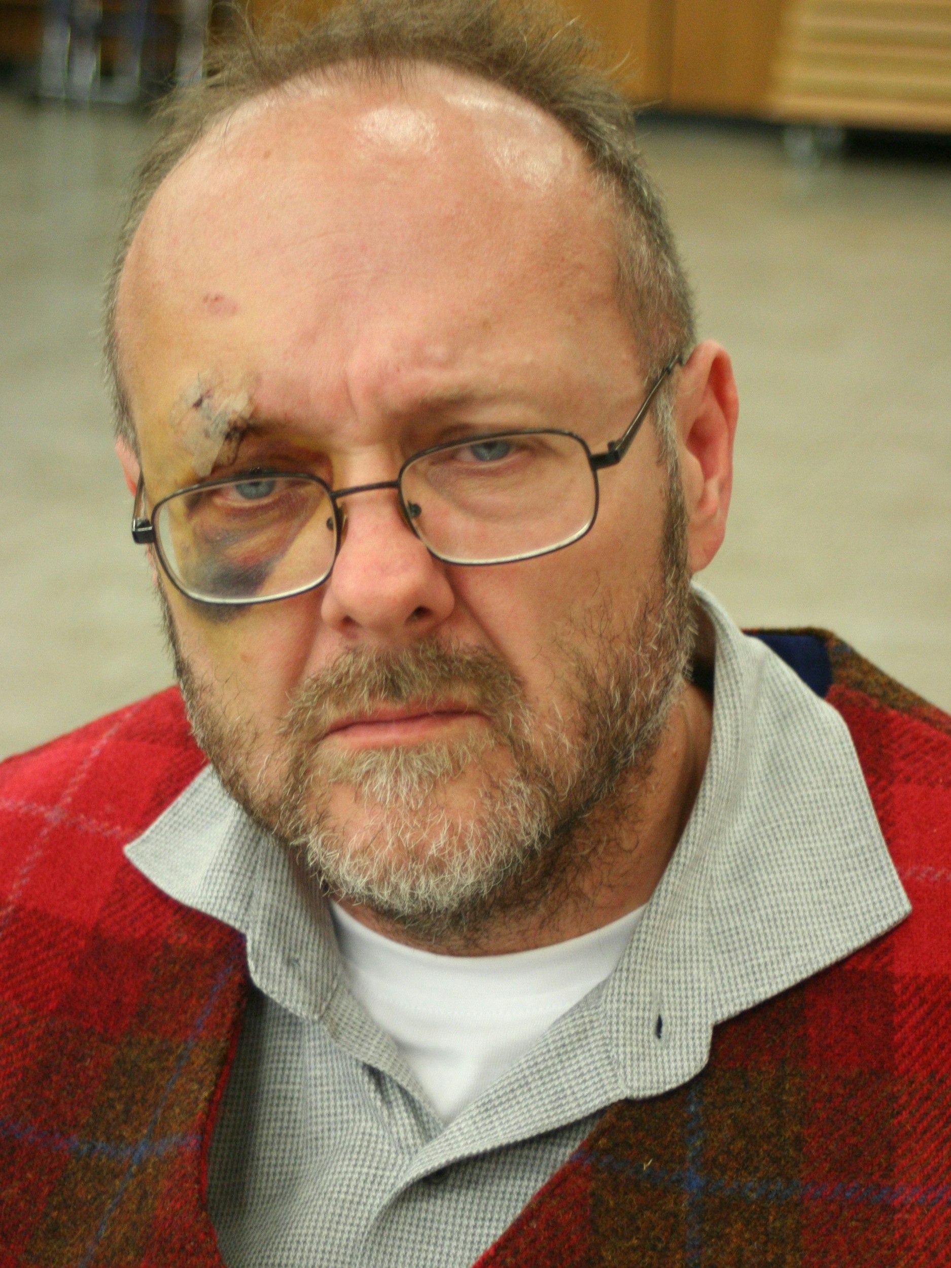 Rainer Tüschenbönner wurde von Unbekannten angegriffen und verletzt.