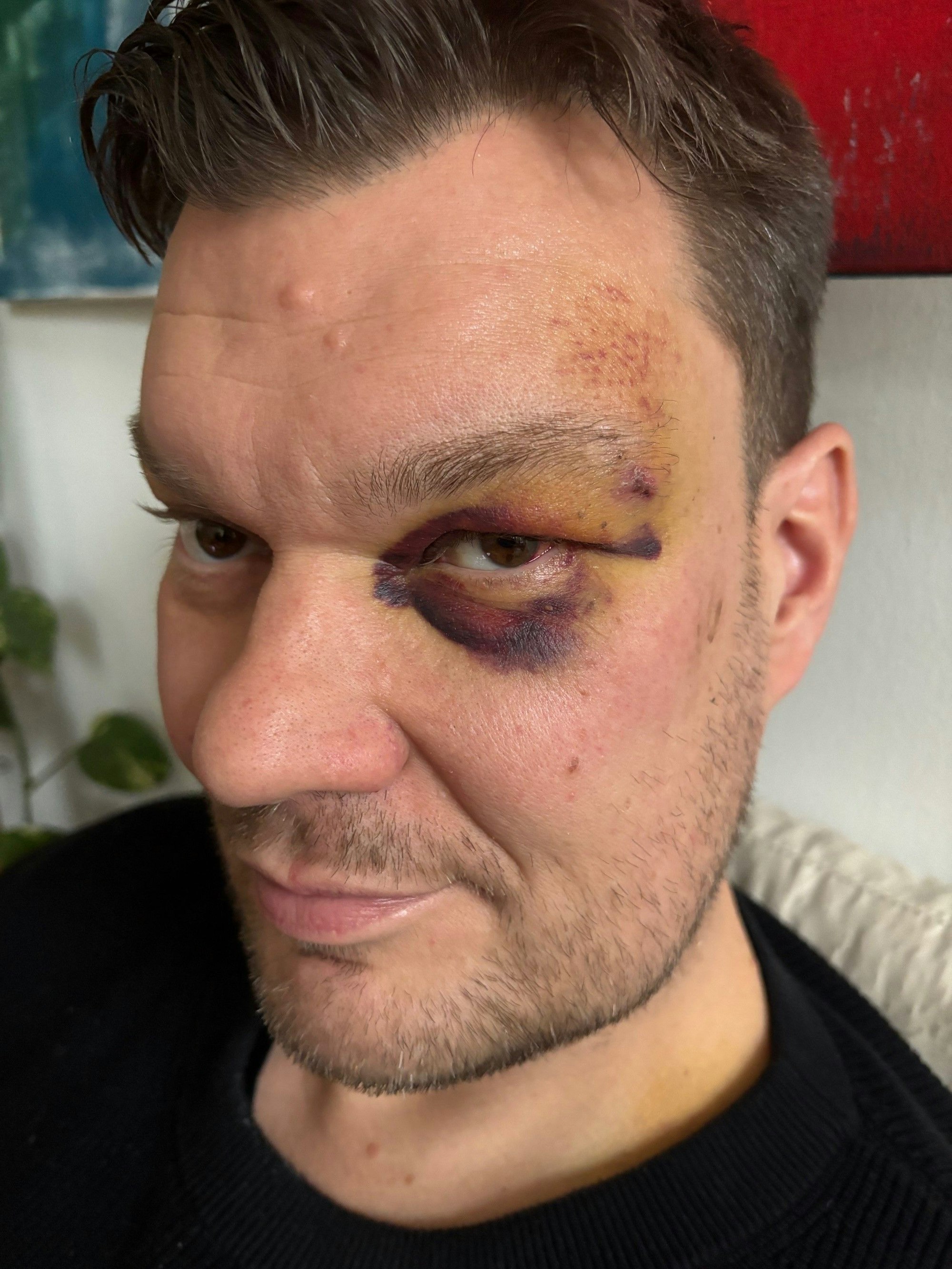 Am 16. Dezember 2025 an der Severinsbrücke bei einem Radunfall schwer verletzt: Carsten Brennecke.