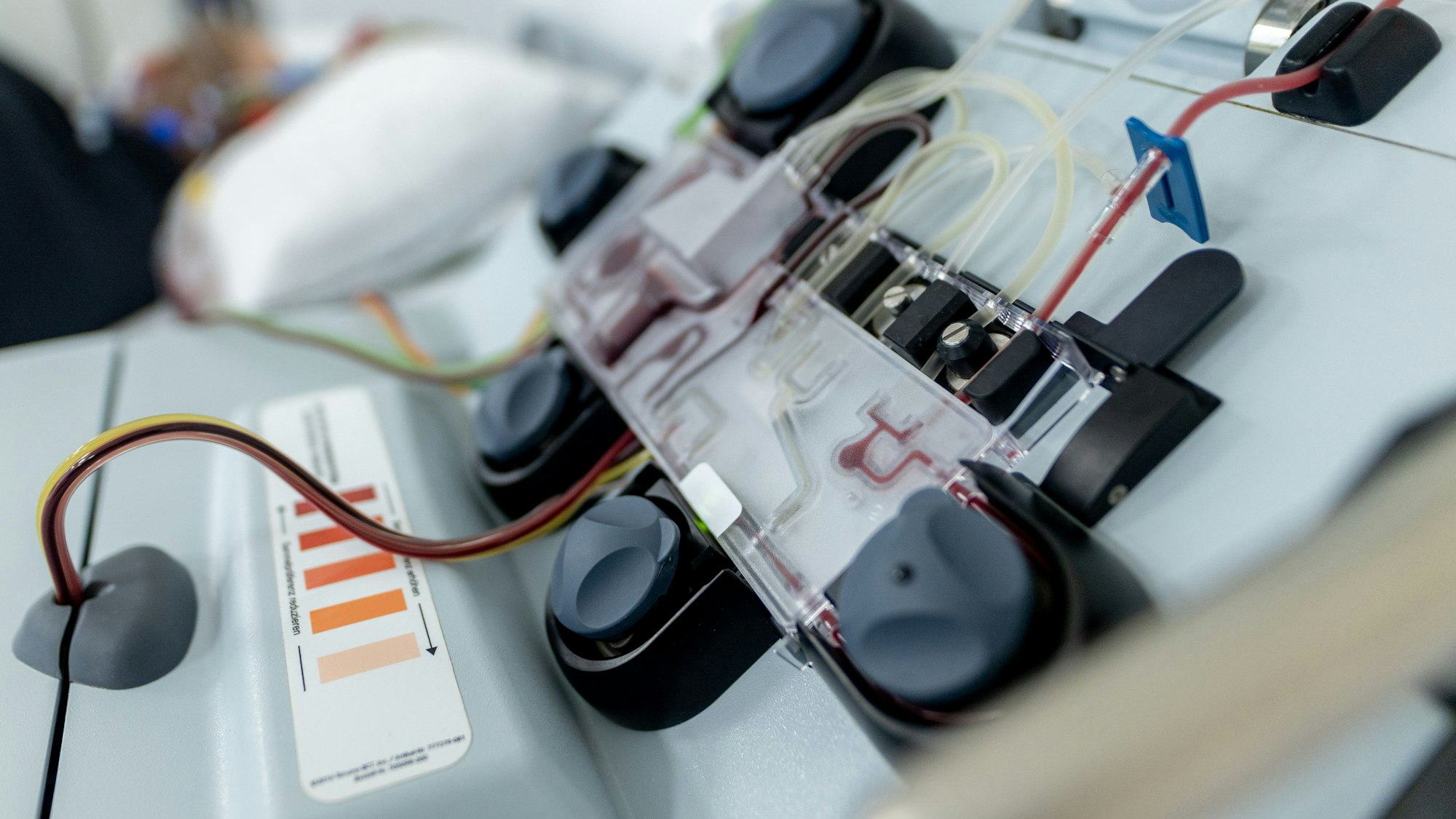 Über Schläuche und Drehteller wird das Blut aus der Vene der Patientin gewaschen. Im Beutel landet die sogenannte weiße Schicht mit den T-Zellen, der Rest der Flüssigkeit fließt zurück in den Körper der Patientin.