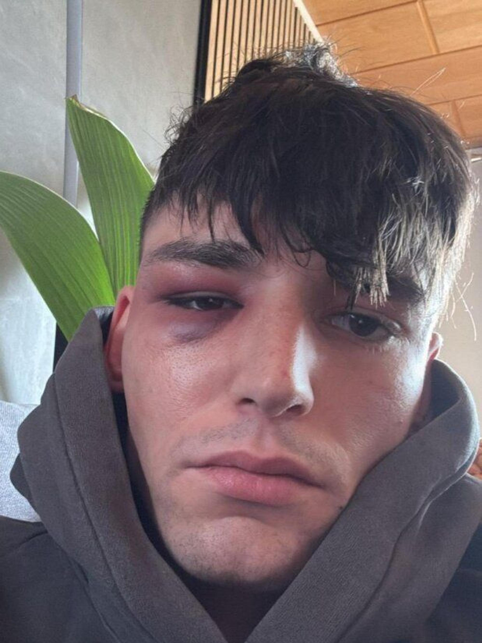 Drei Männer sollen Pascal Kaiser in seinem Garten angegriffen haben.