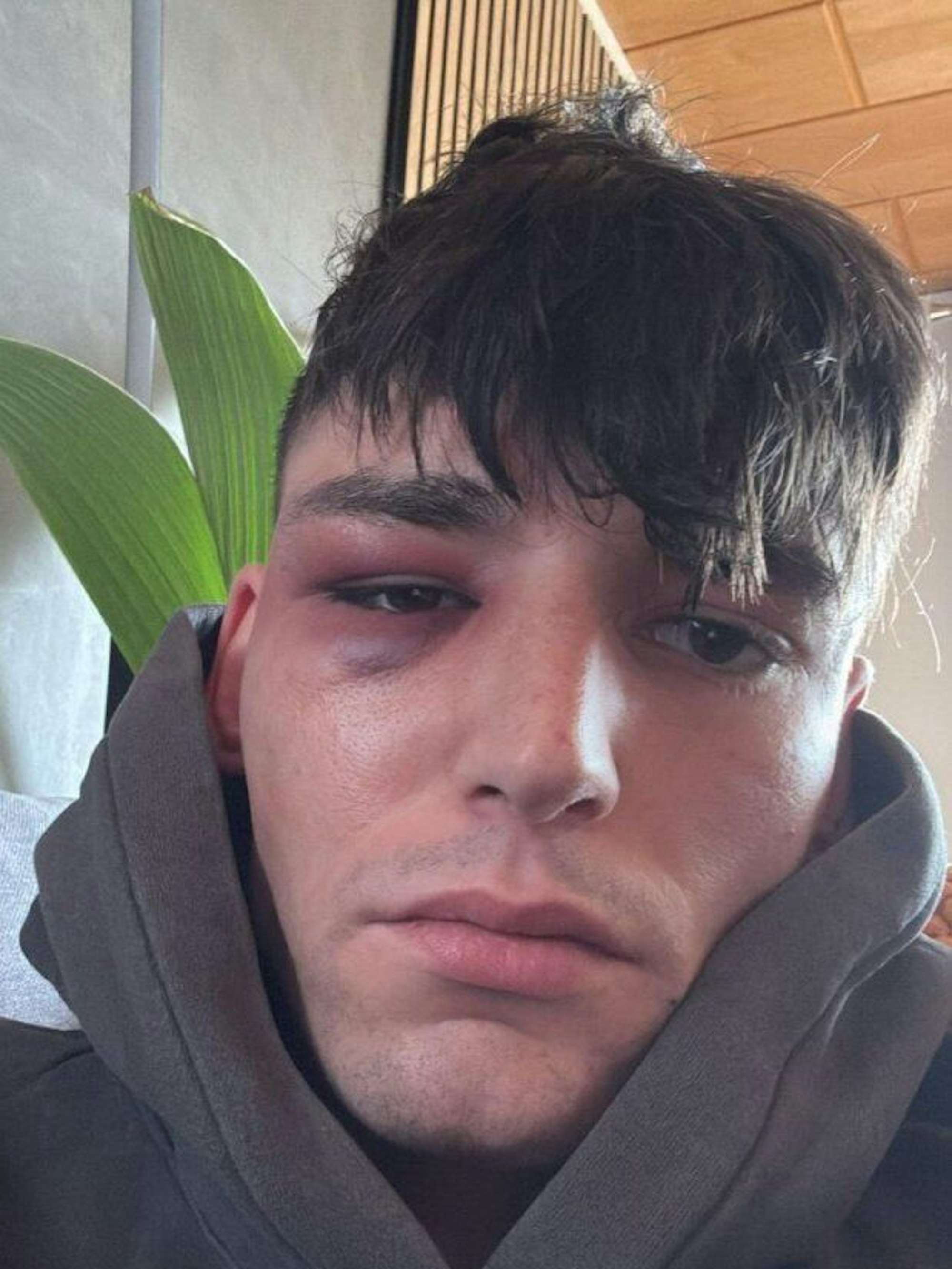 Drei Männer sollen Pascal Kaiser in seinem Garten angegriffen haben.