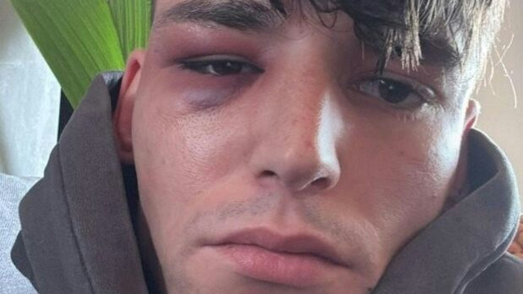 Unbekannte haben Pascal Kaiser angegriffen.