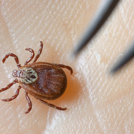 Eine Zecke in Nahaufnahme auf einer Handfläche.