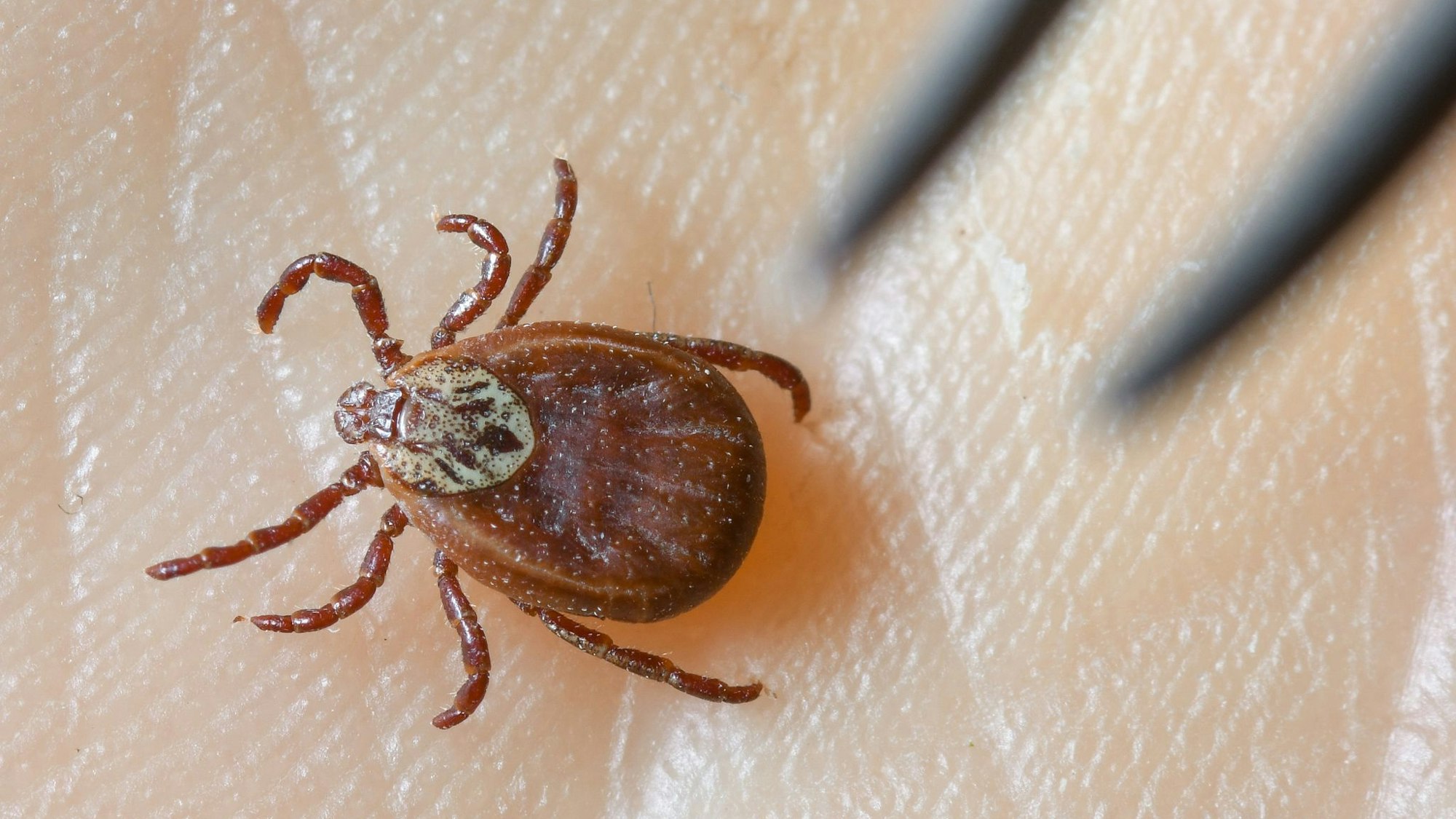 Eine Zecke in Nahaufnahme auf einer Handfläche.
