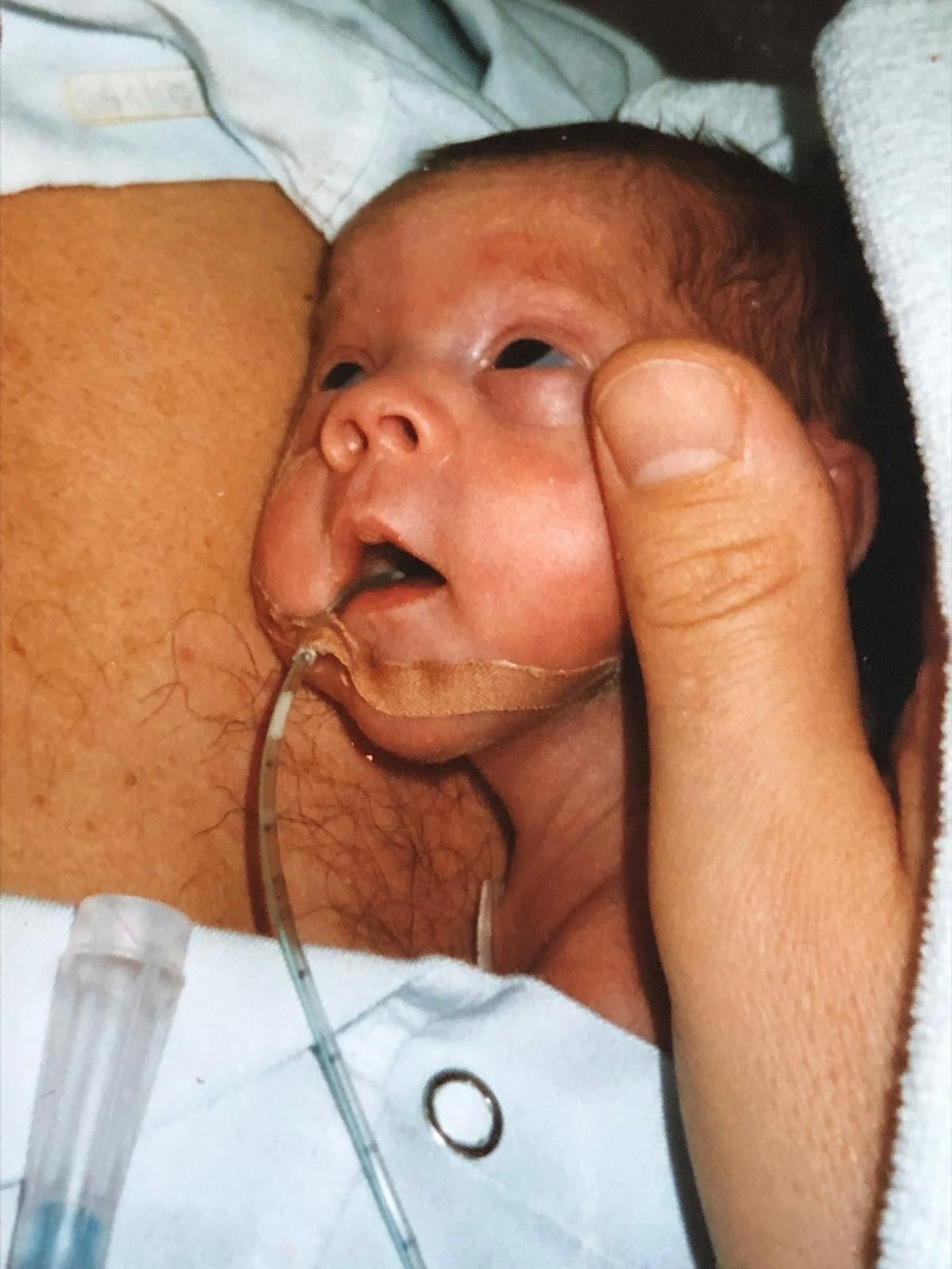 Das Frühchen im Alter von sechs Wochen im Uniklinikum Tübingen auf der Brust des Vaters