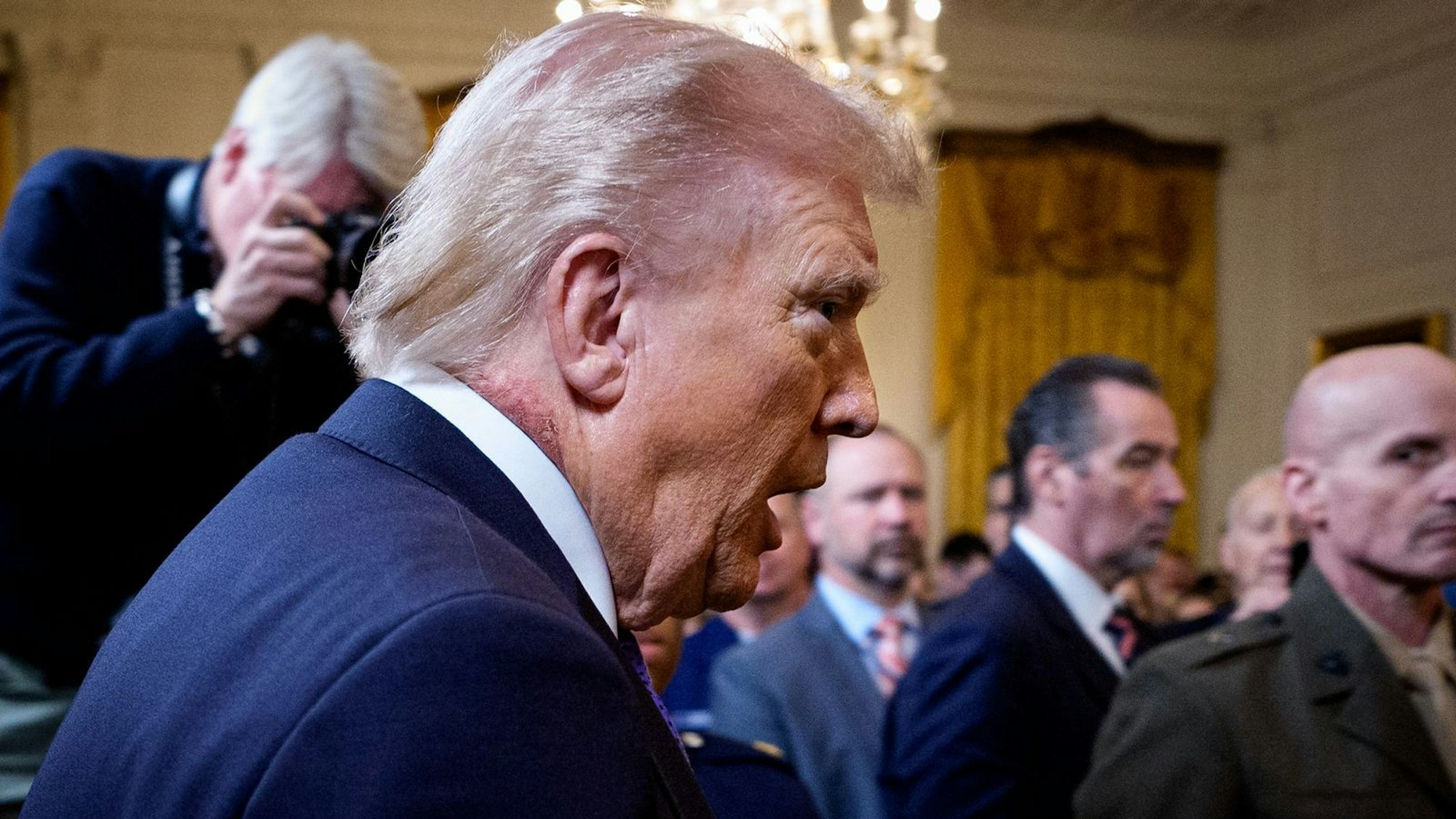 Die Rötung am Hals von US-Präsident Donald Trump sorgt derzeit für wilde Spekulationen. (Bild: 2026 Getty Images/Andrew Harnik)