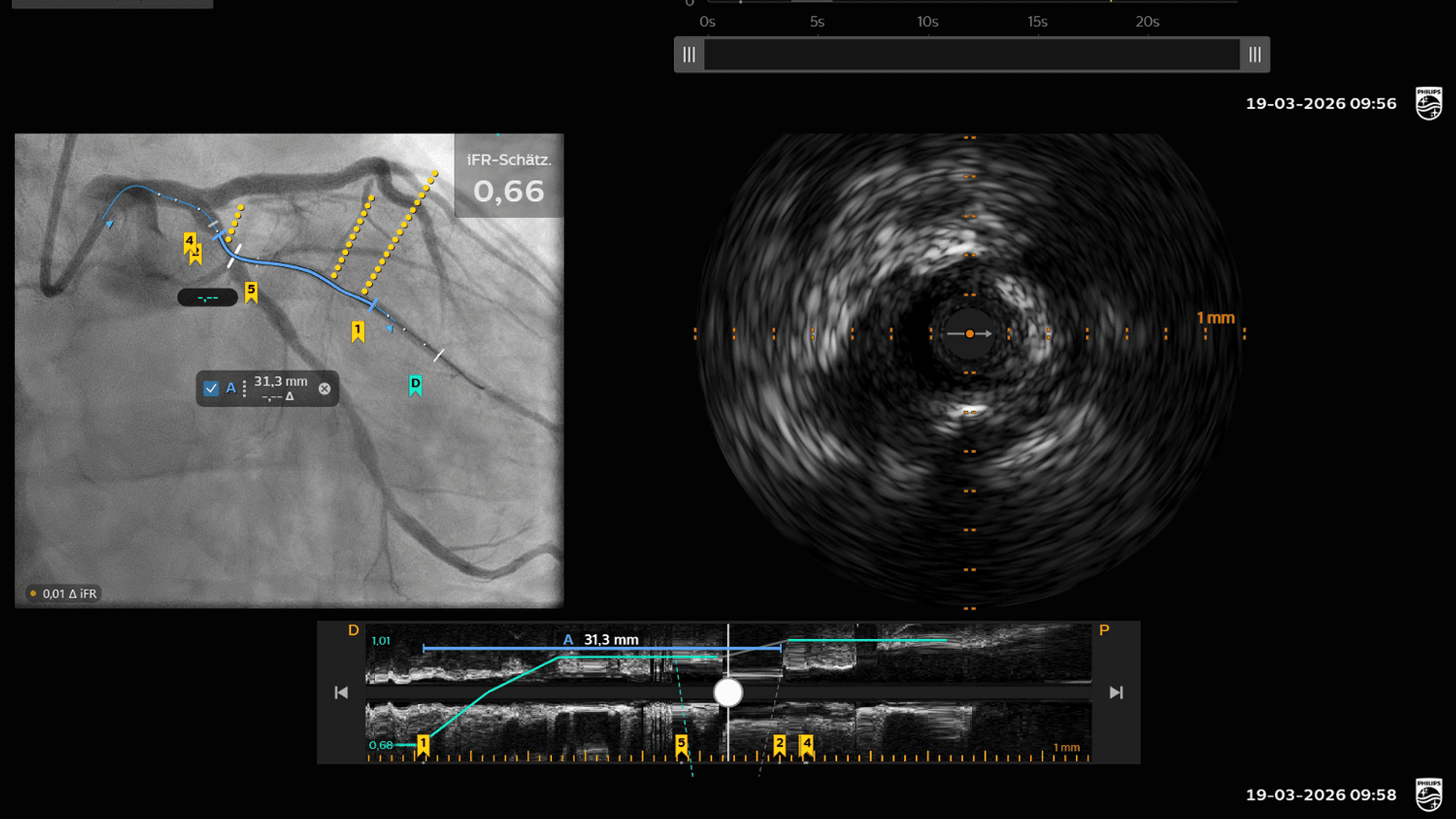 Herzkatheteruntersuchung mit der neuen Diagnose-Plattform „IntraSight Plus“ von Philips im Kölner St.-Vinzenz-Krankenhaus.
