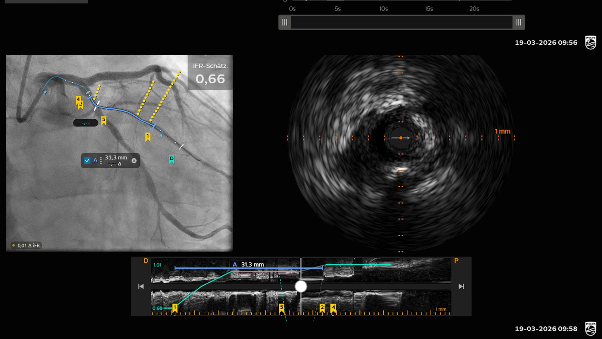 Herzkatheteruntersuchung mit der neuen Diagnose-Plattform „IntraSight Plus“ von Philips im Kölner St.-Vinzenz-Krankenhaus.