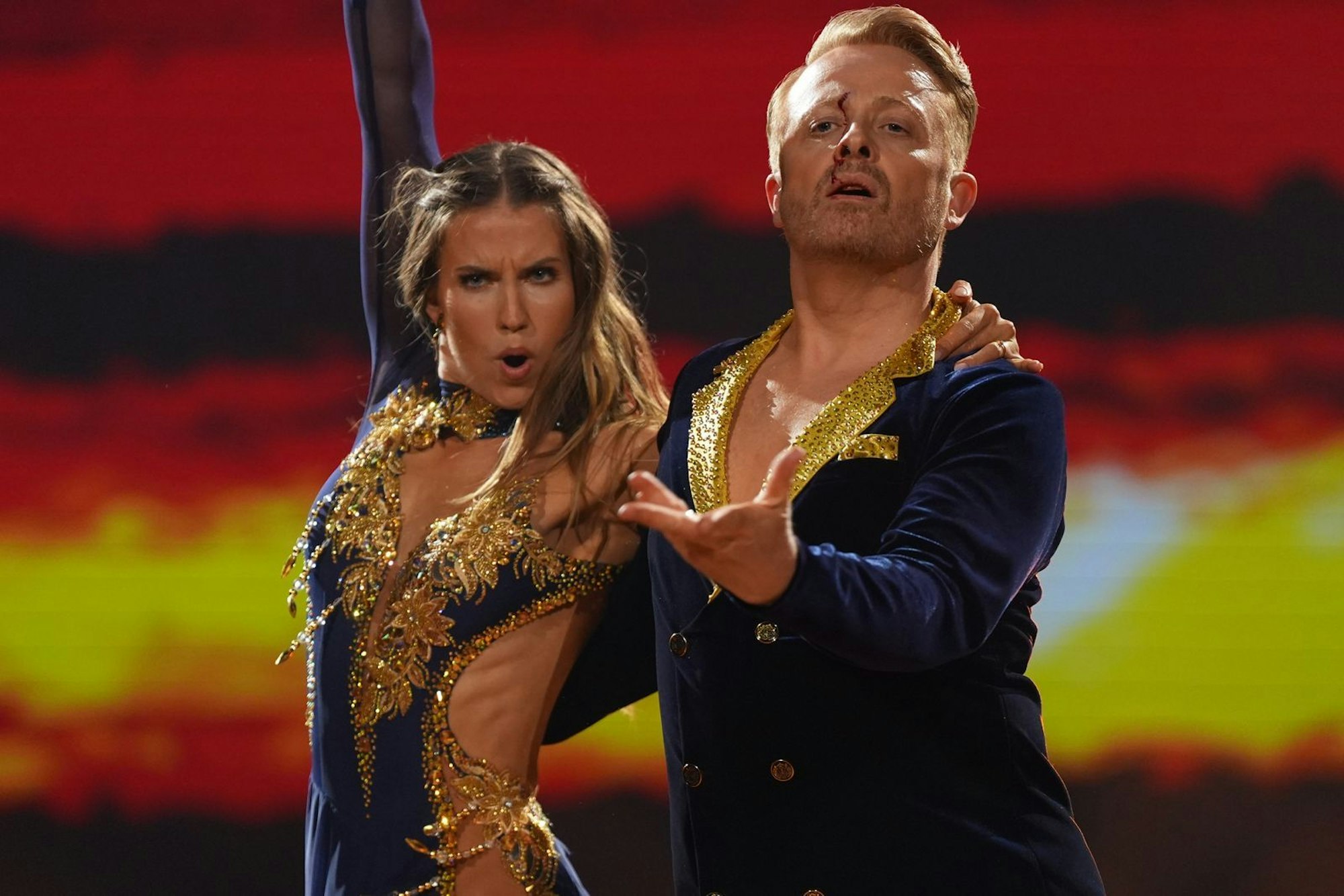 Tanzpartnerin Mariia Maksina trifft Sänger Ross Antony bei der Rumba zu „Human Nature“ an der Stirn. Moderator Daniel Hartwich: „Es sollte doch Herzblut sein, nicht Stirnblut“ (Bild: RTL / Stefan Gregorowius)