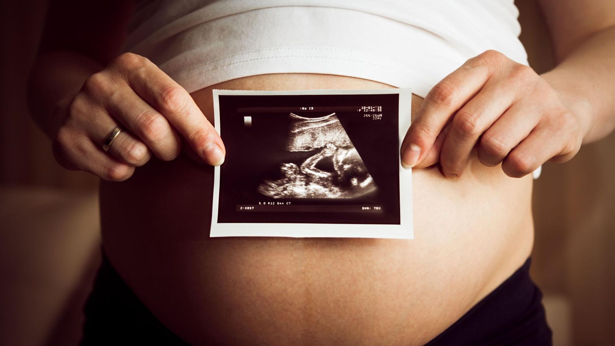 Eine schwangere Frau hält ein Ultraschallbild ihres Fötus vor den Bauch.