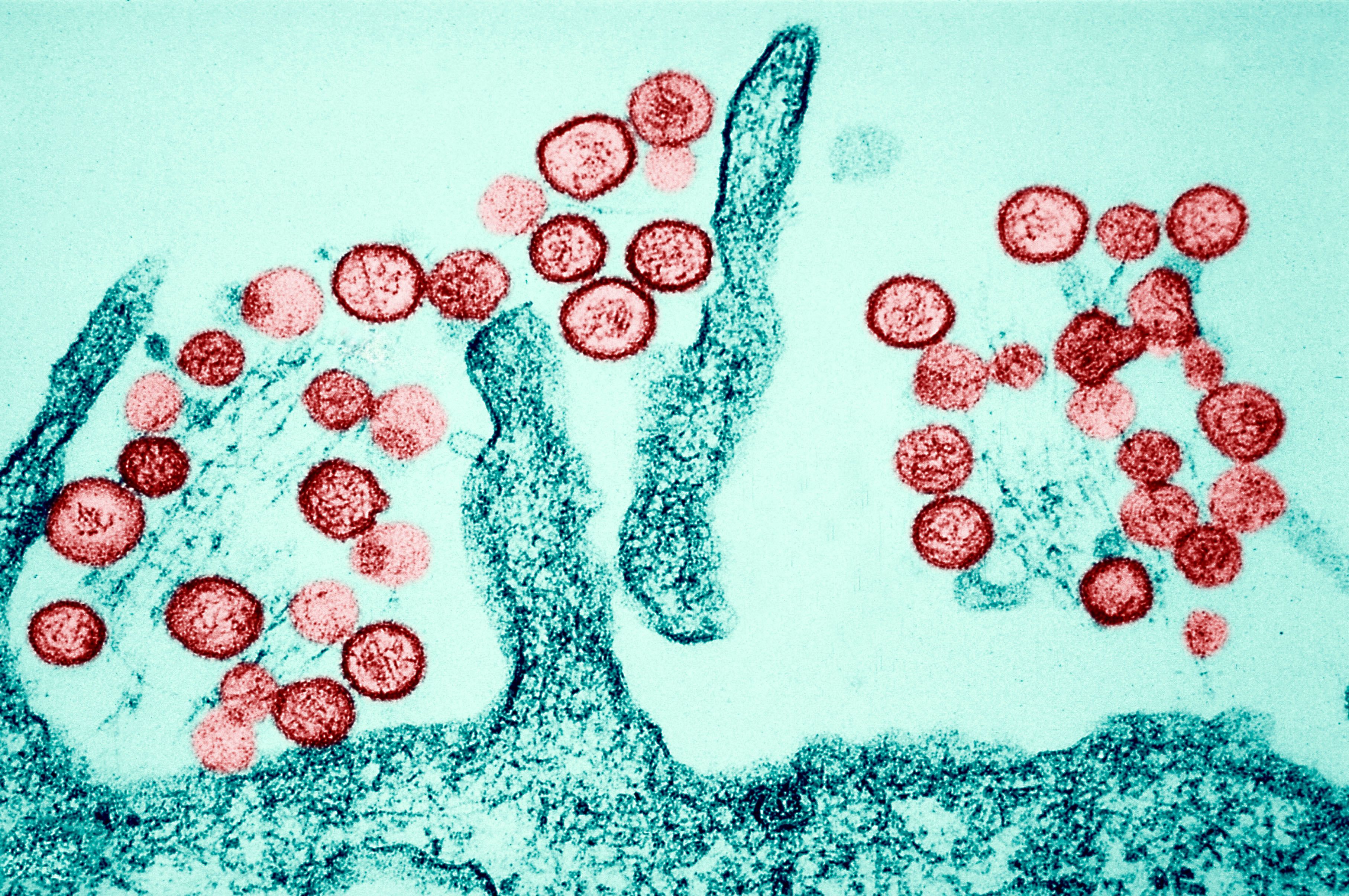 Eine mikroskopische Aufnahme zeigt das Hantavirus. Hantaviren werden überwiegend durch den Kot von Nagetieren übertragen. (Archivbild)