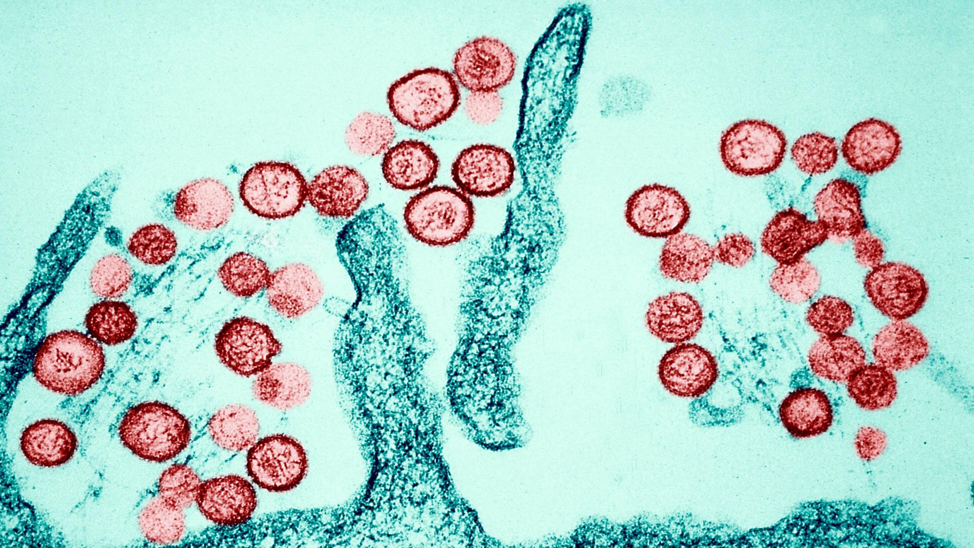 Eine mikroskopische Aufnahme zeigt das Hantavirus. Hantaviren werden überwiegend durch den Kot von Nagetieren übertragen. (Archivbild)