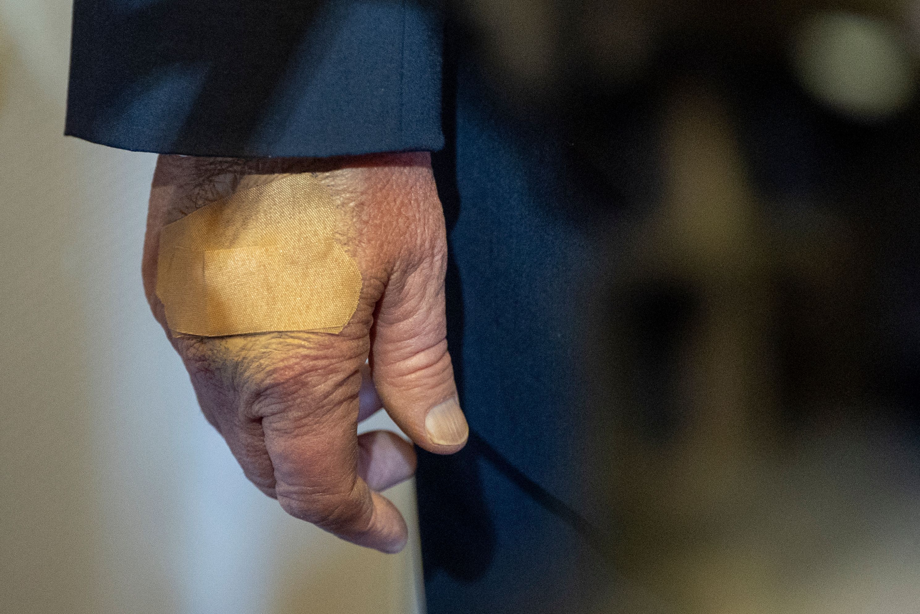 Die rechte Hand von US-Präsident Donald Trump ist bandagiert, als er mit Reportern spricht. (Archivbild)