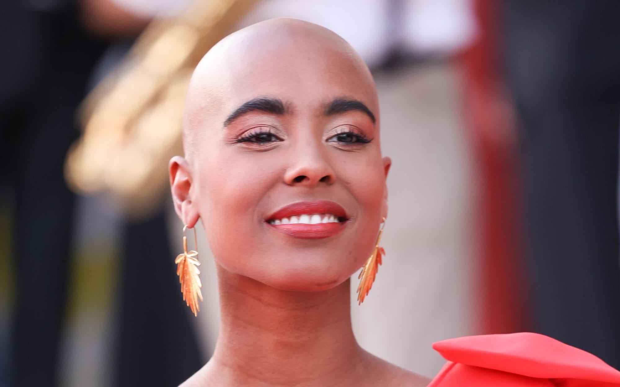 Sharon Battiste hat über eine unschöne Erfahrung aus ihrer Kindheit gesprochen. (Bild: 2023 Getty Images/Gerald Matzka)