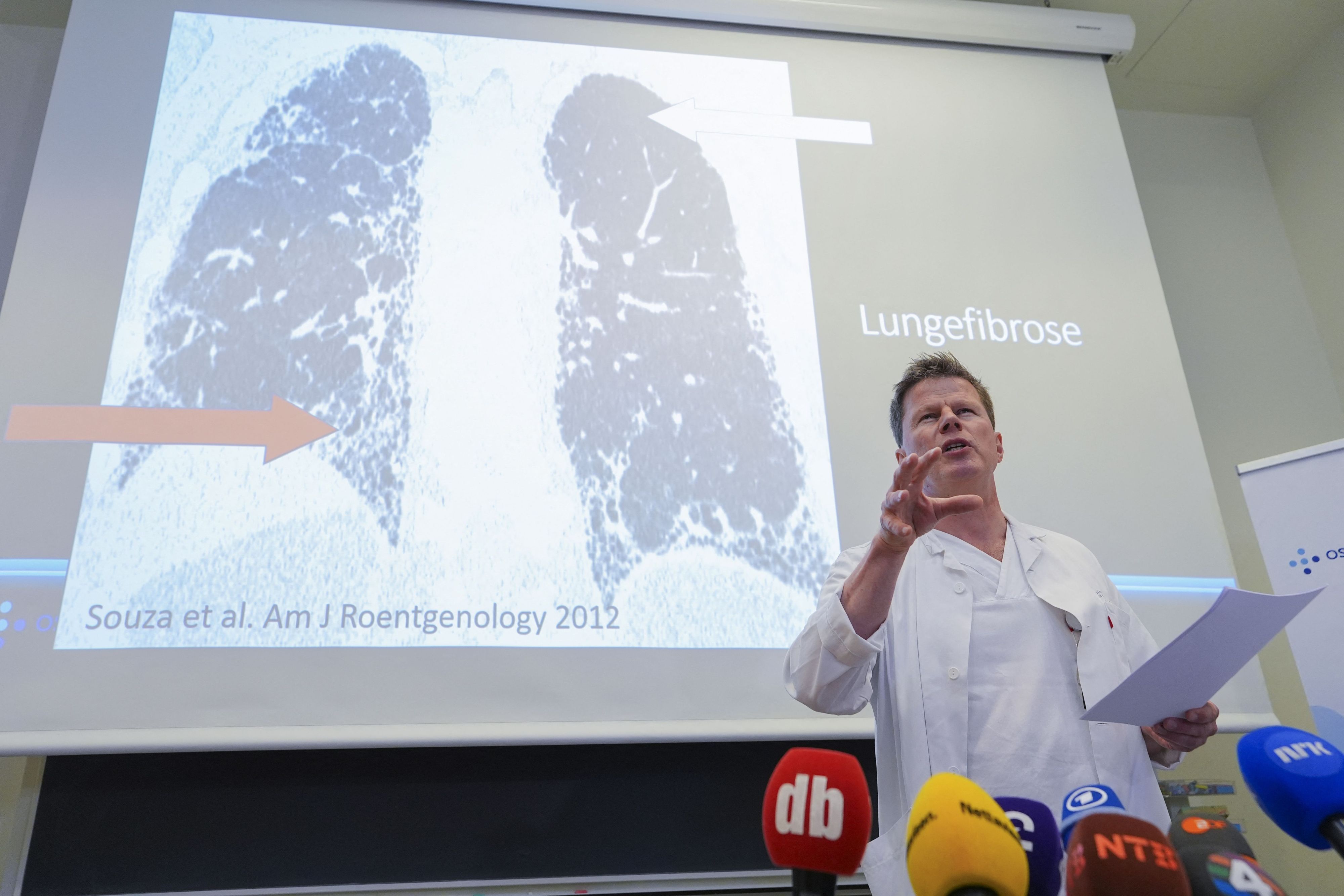 Lungenspezialist Are Holm äußert sich am Freitag (5. Juni) zur Erkrankung von Kronprinzessin Mette-Marit.