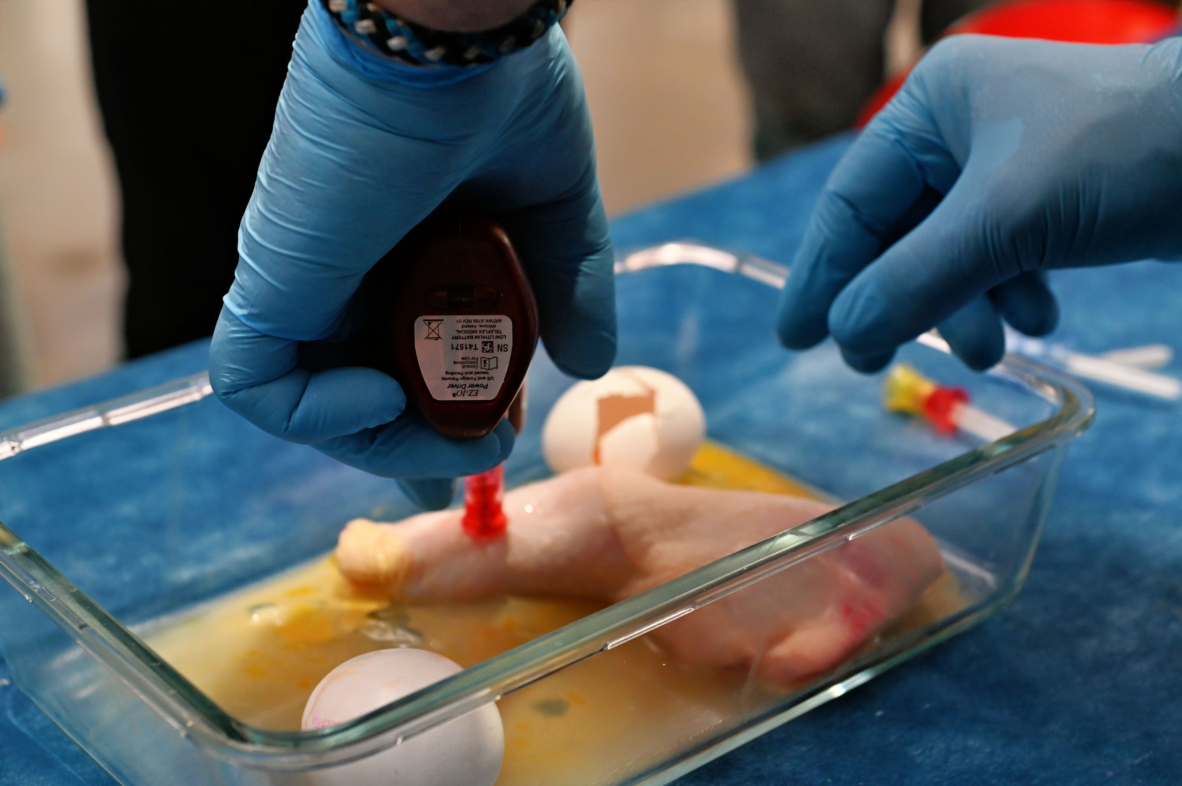 In einer Glasschale liegt ein künstlicher Finger, in den eine Infusion gesetzt wird.