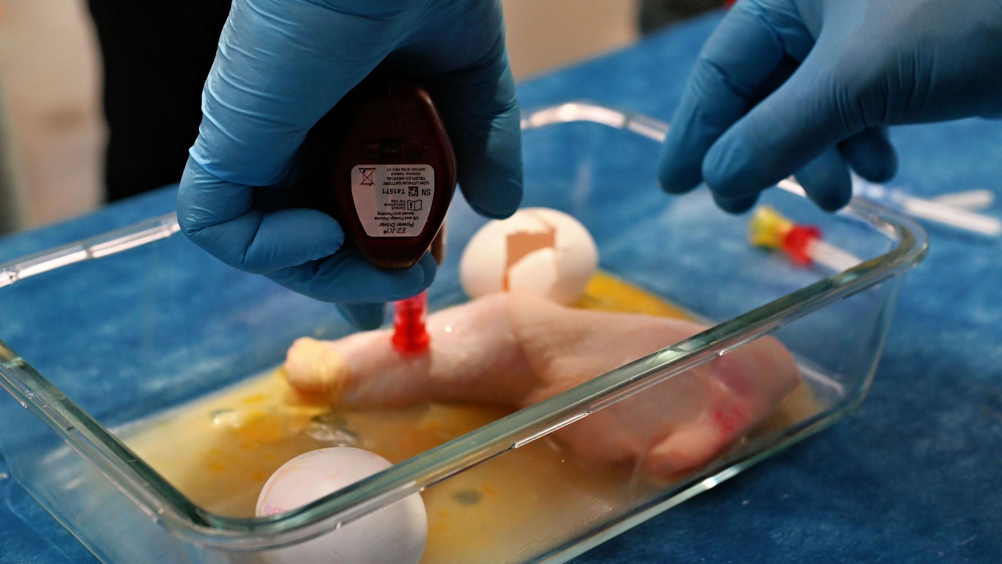 In einer Glasschale liegt ein künstlicher Finger, in den eine Infusion gesetzt wird.