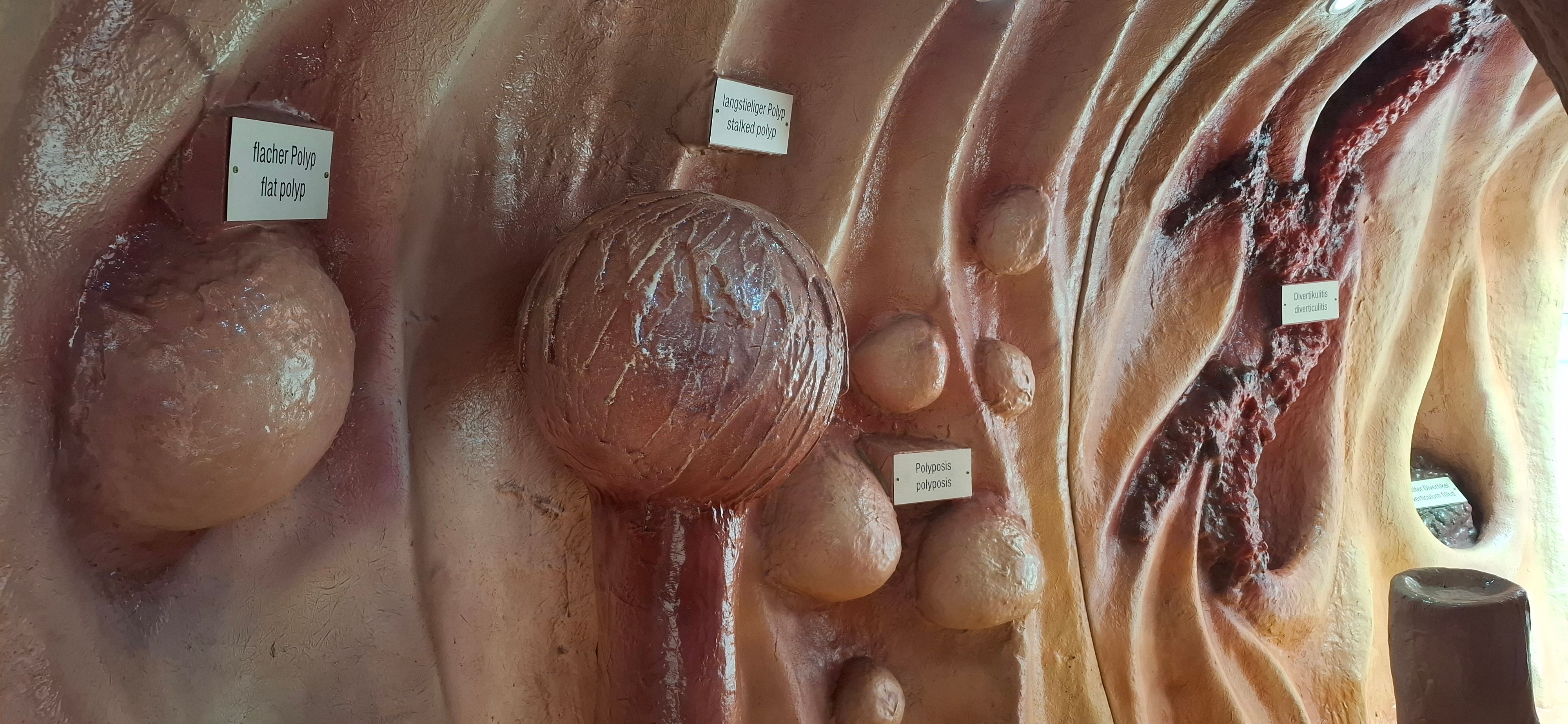 Darmmodell von innen