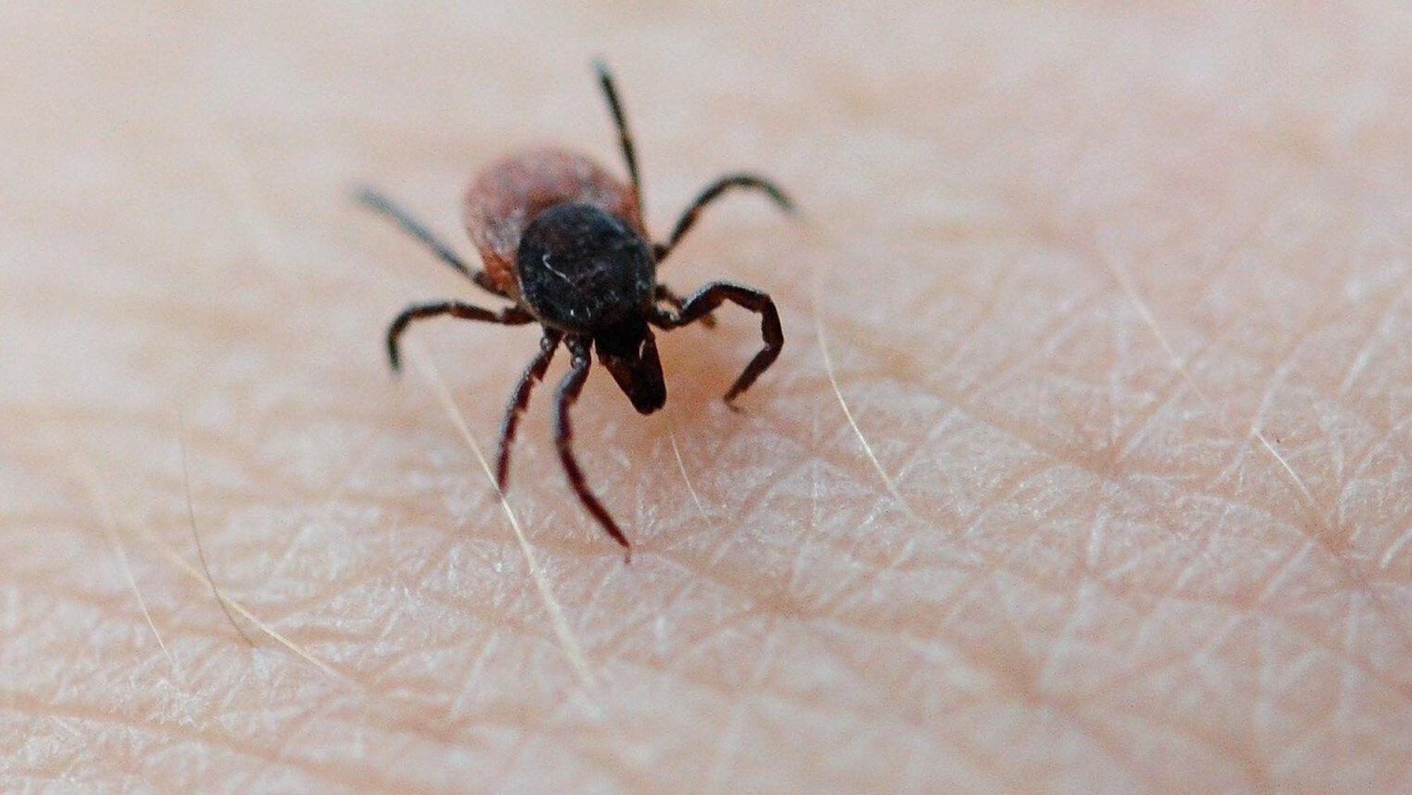 Eine Zecke krabbelt über die Hand eines Mannes. (Symbolfoto)