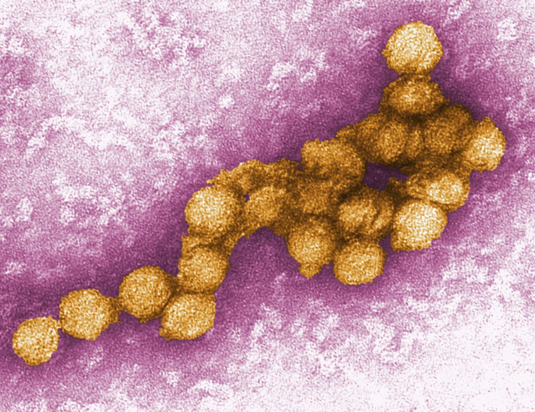 West-Nil-Virus