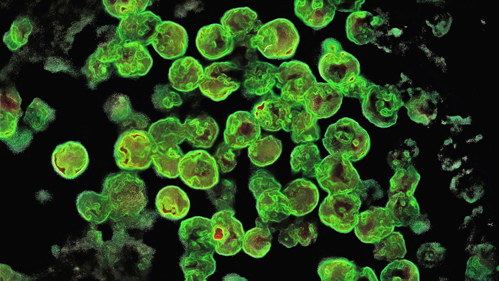 Naegleria fowleri unter dem Mikroskop (Archiv)