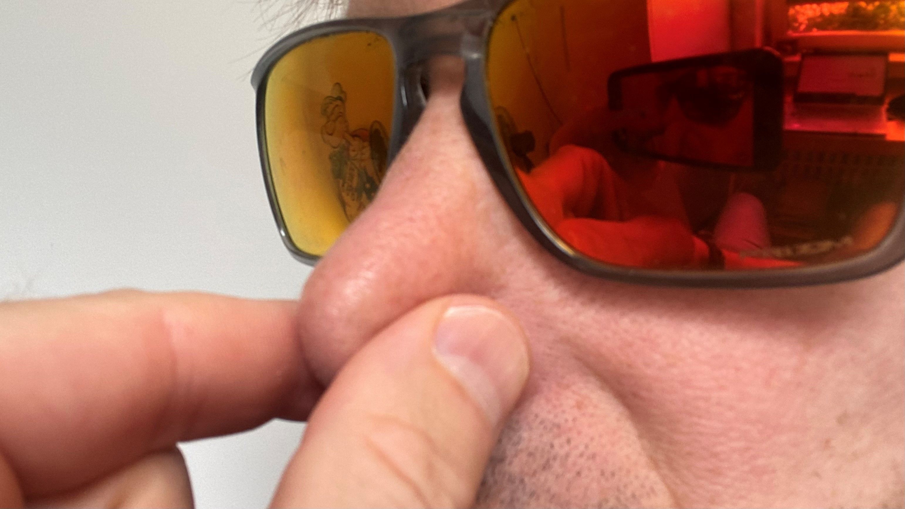 Ein Mann hält sich die Nase zu.