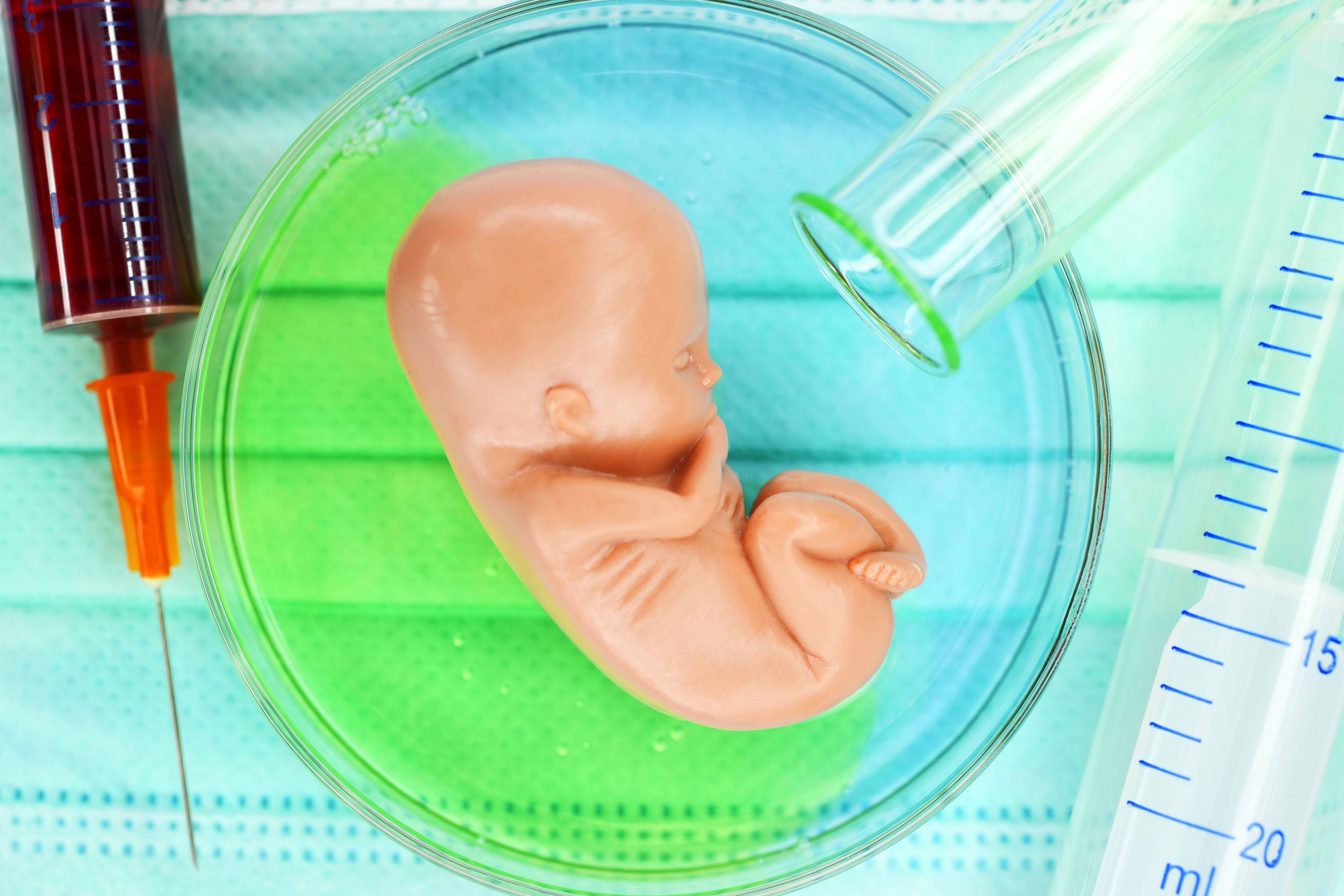 Fötus-Figur in einer Petrischale, Symbolfoto Pränataldiagnostik *** Fetal figure in a Petri dish Symbol photo Prenatal diagnostics