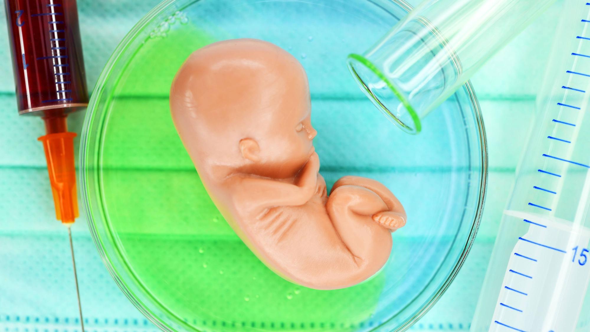 Fötus-Figur in einer Petrischale, Symbolfoto Pränataldiagnostik *** Fetal figure in a Petri dish Symbol photo Prenatal diagnostics