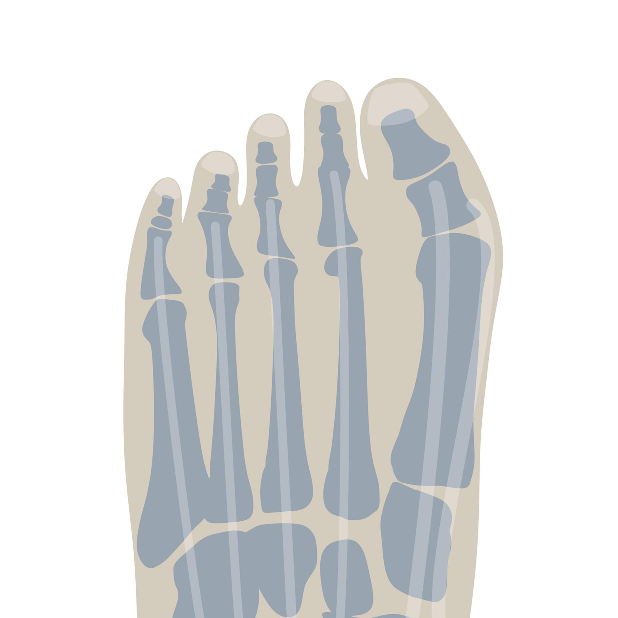 Wie_Schuhe_die_Bildu_50090310