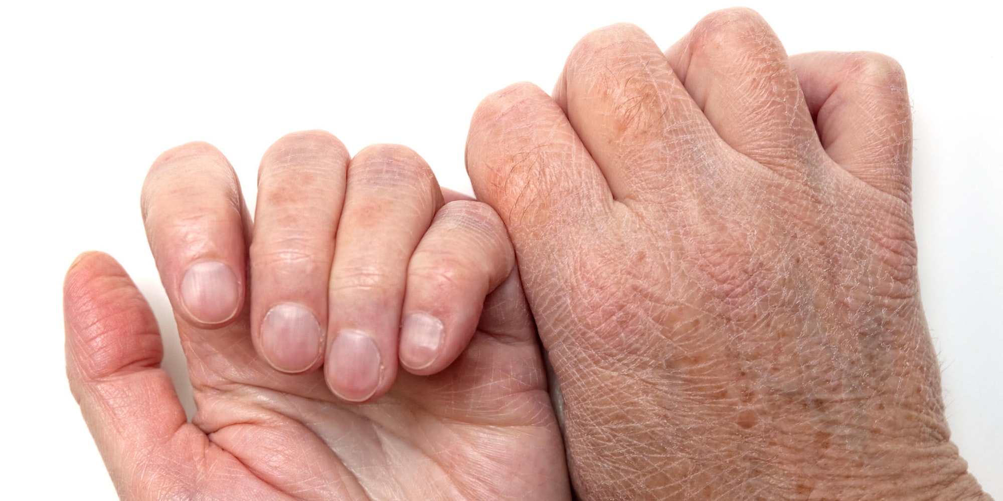 GettyImages-157435497