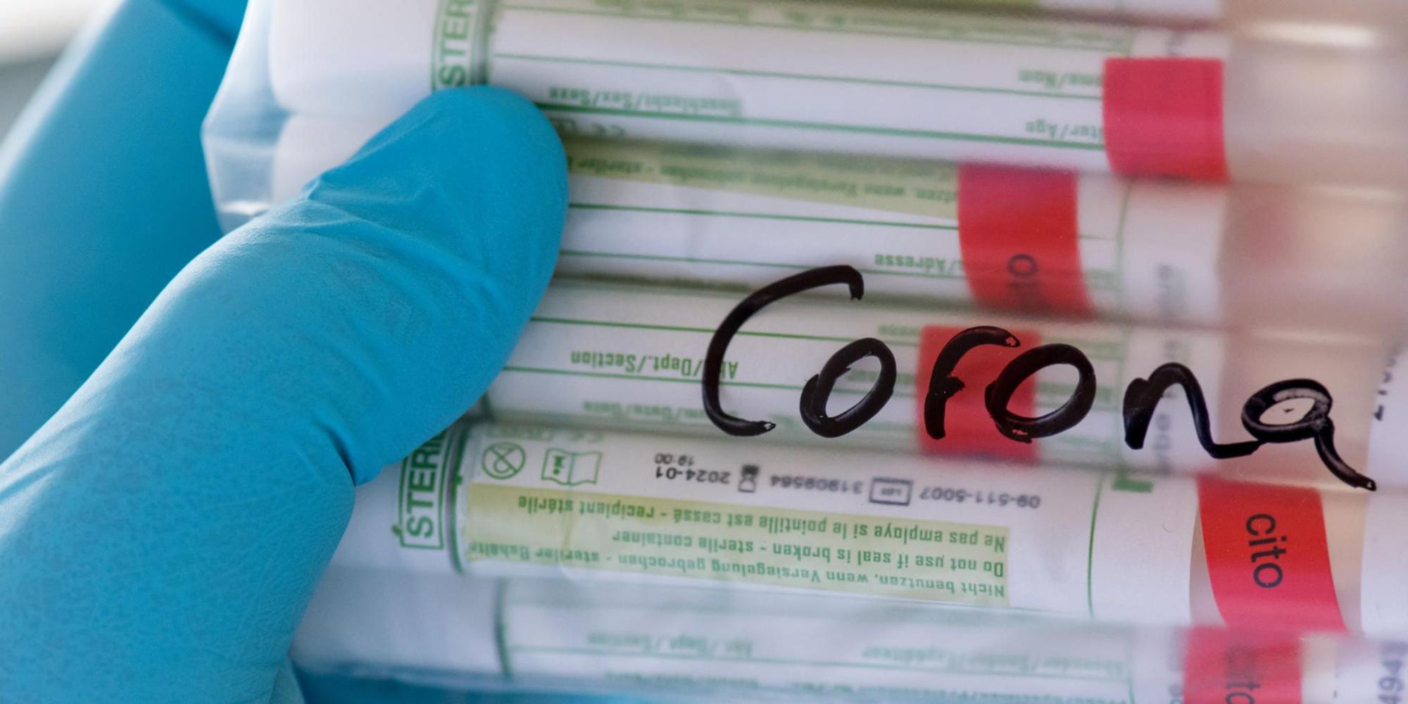 Coronavirus_Test